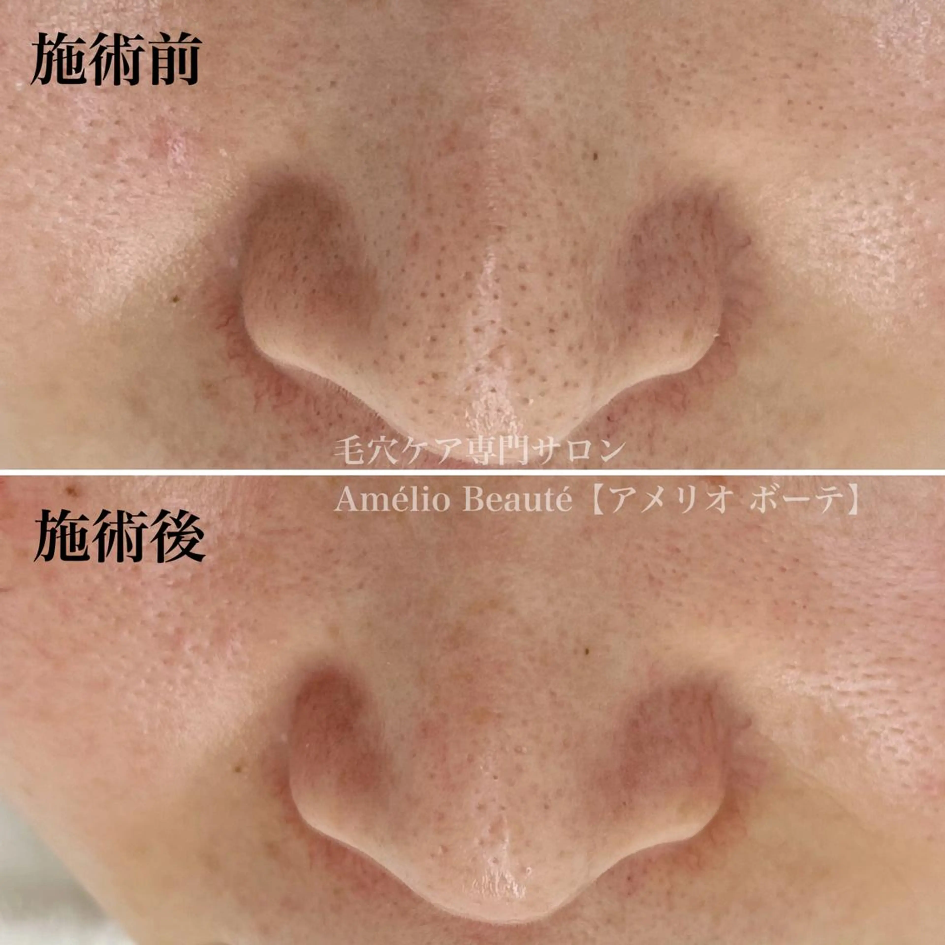 毛穴ケア専門サロン アメリオボーテのその他イメージ