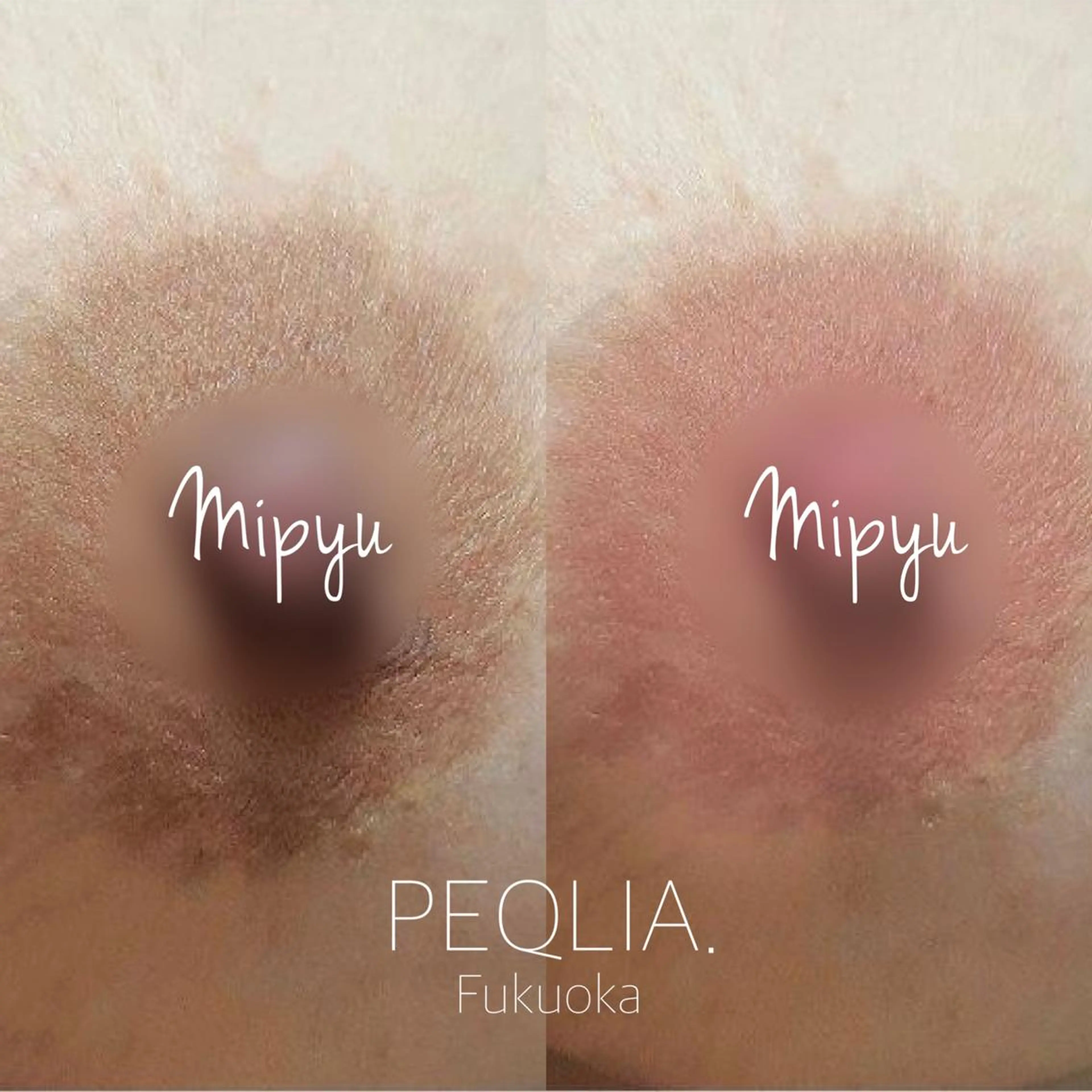 【最新メラニンケア/Mipyu】乳輪・乳頭/アフタークリーム1ヶ月分付の写真