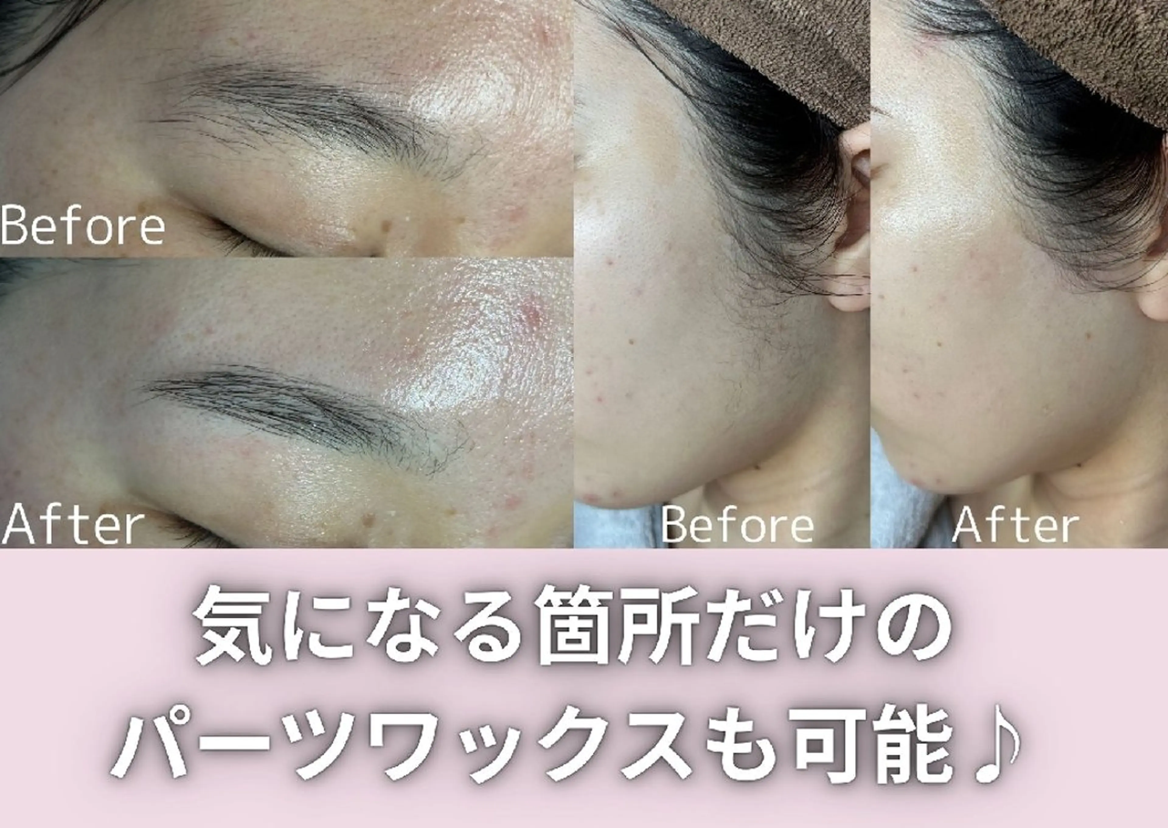 モン エピレなんば店のエステ・リラクイメージ