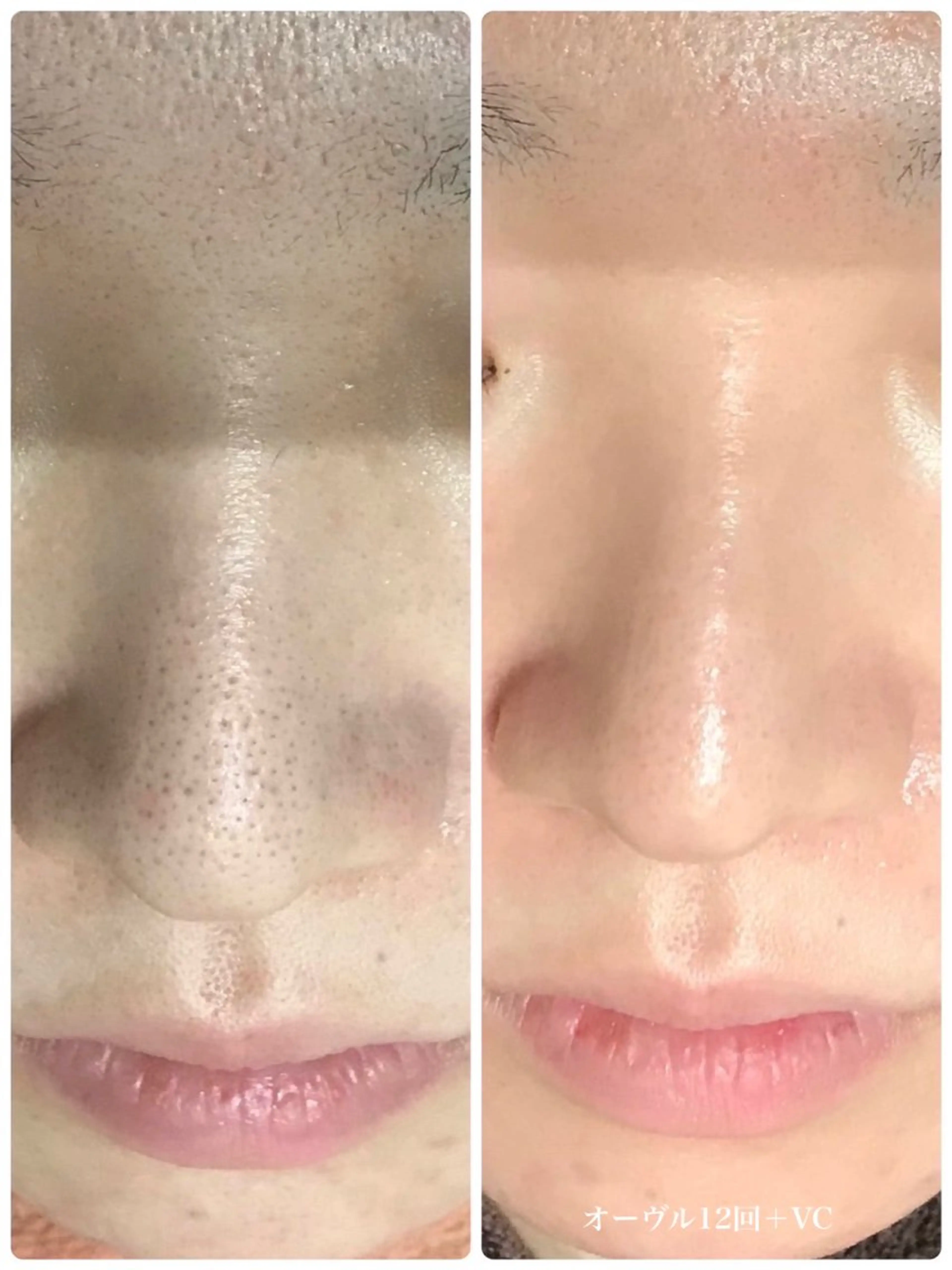 Bébé×DiDiA 野々市市役所前店のエステ・リラクイメージ