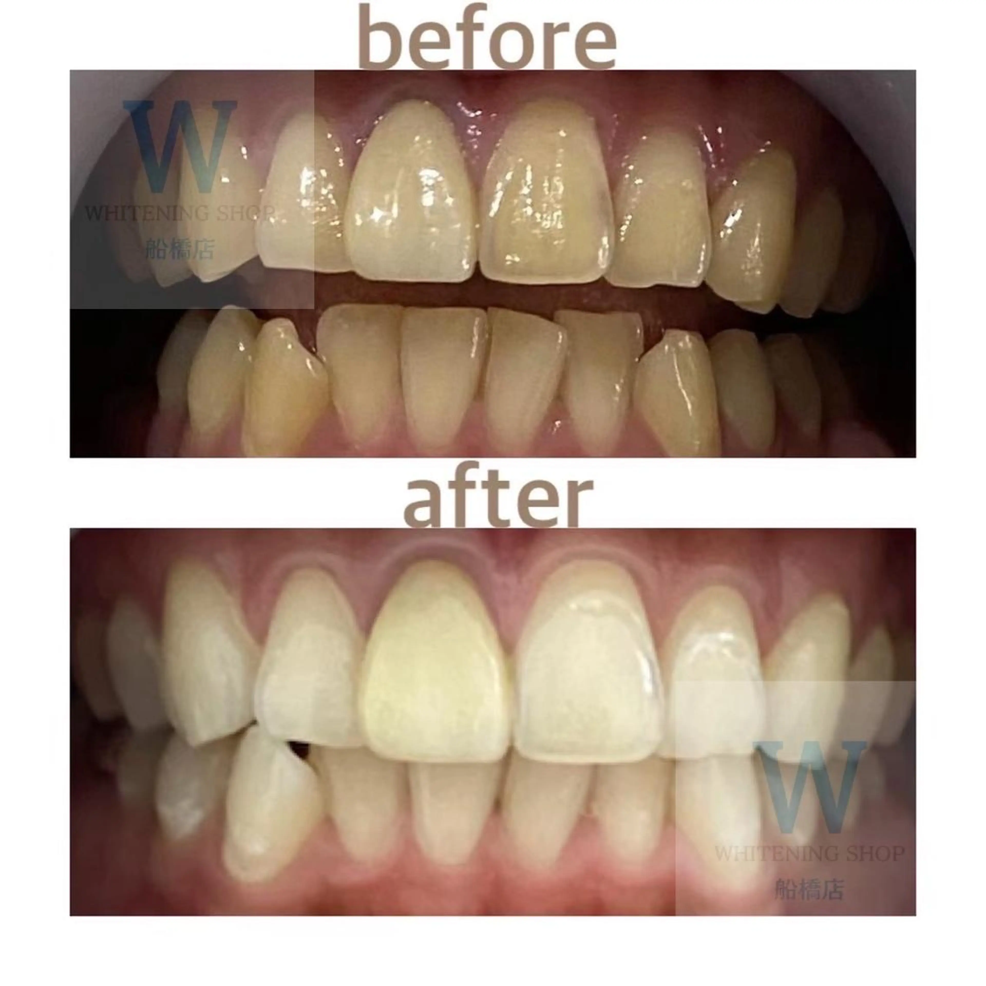 ホワイトニング ショップ船橋店🦷のエステ・リラクイメージ