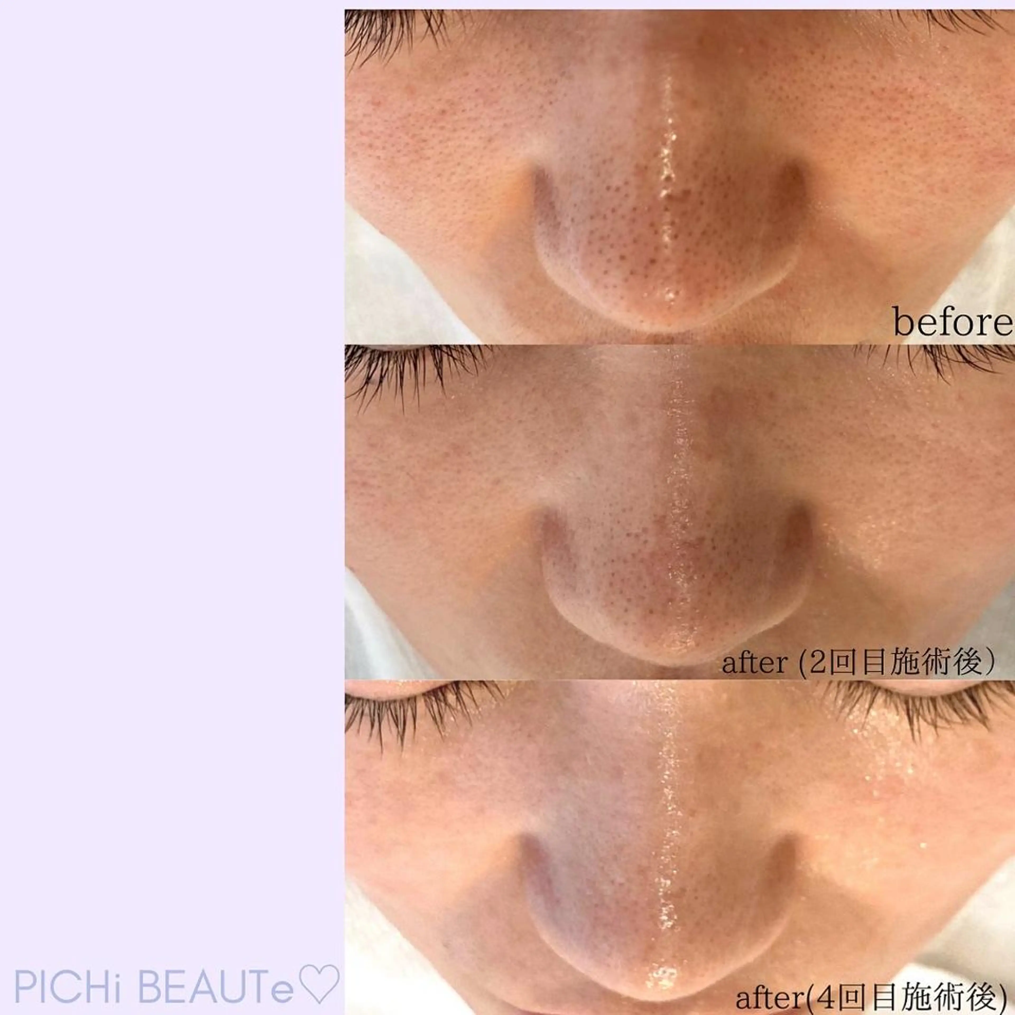 トクシゲ マホのエステ・リラクイメージ