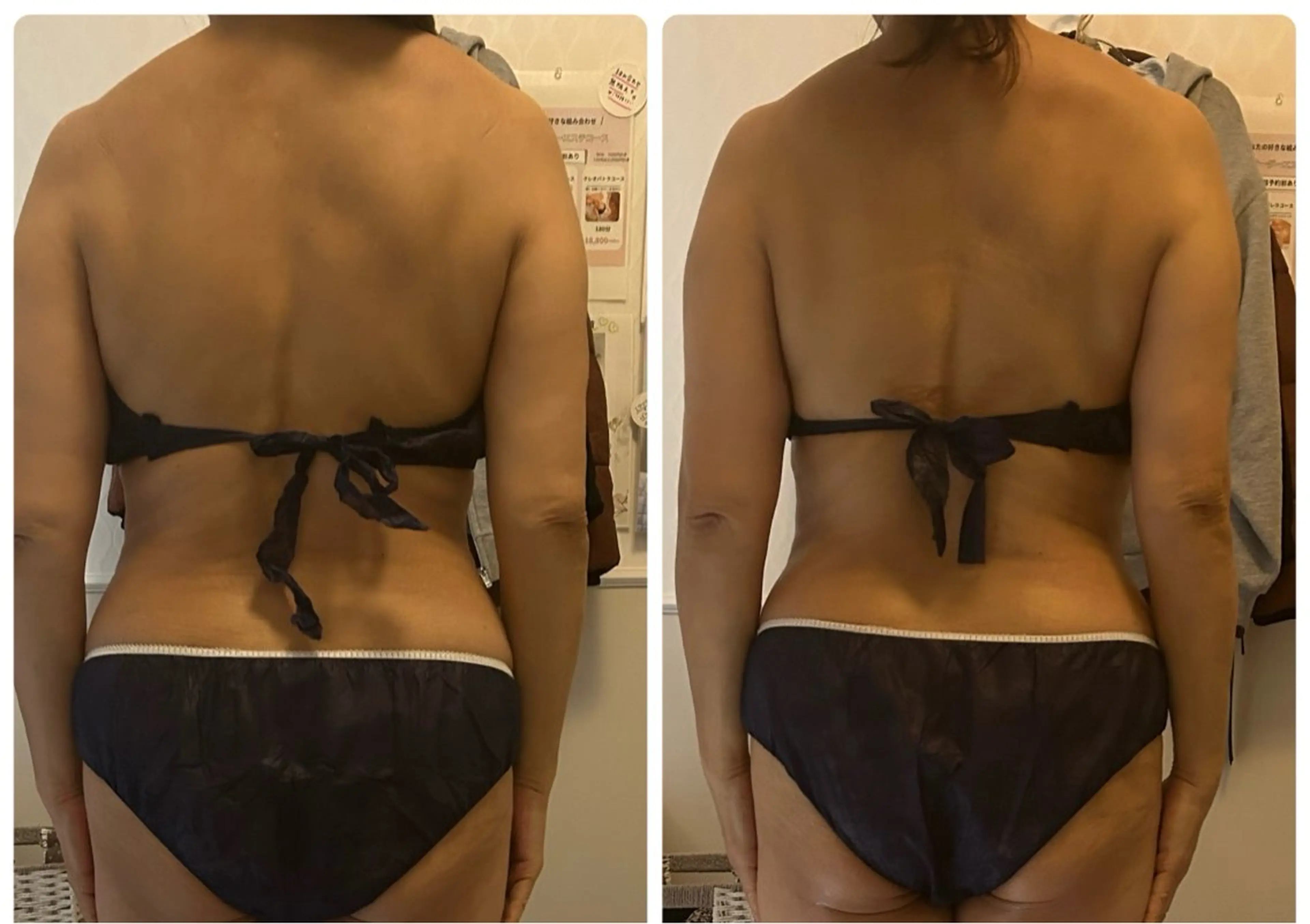 その他 esthesalon Ran所属・小顔美肌痩身サロン Ranのその他イメージ