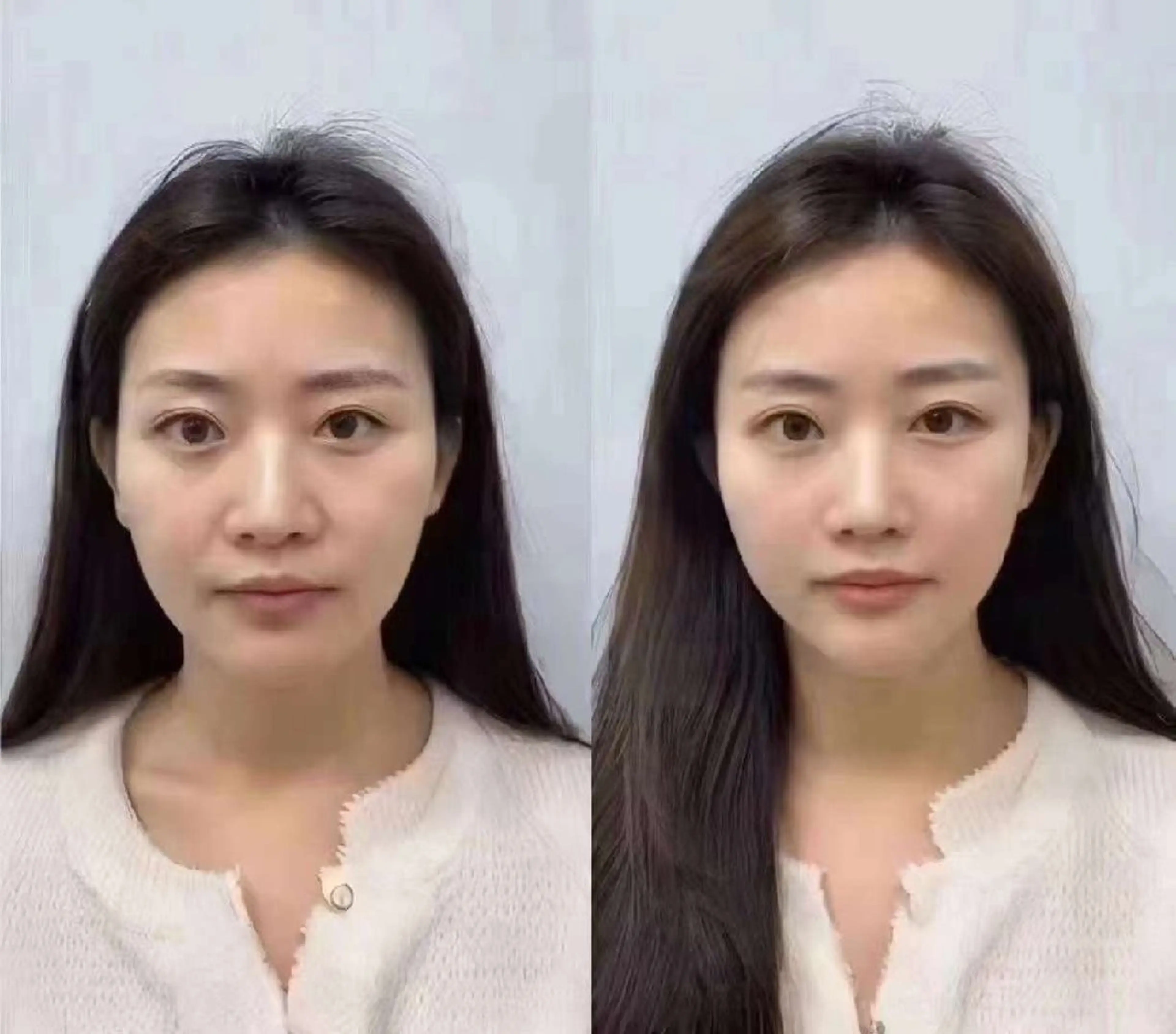 ネイル ブライダルネイル ホワイト aliaハーブ水光店 エステティシャン募集のエステ・リラクイメージ