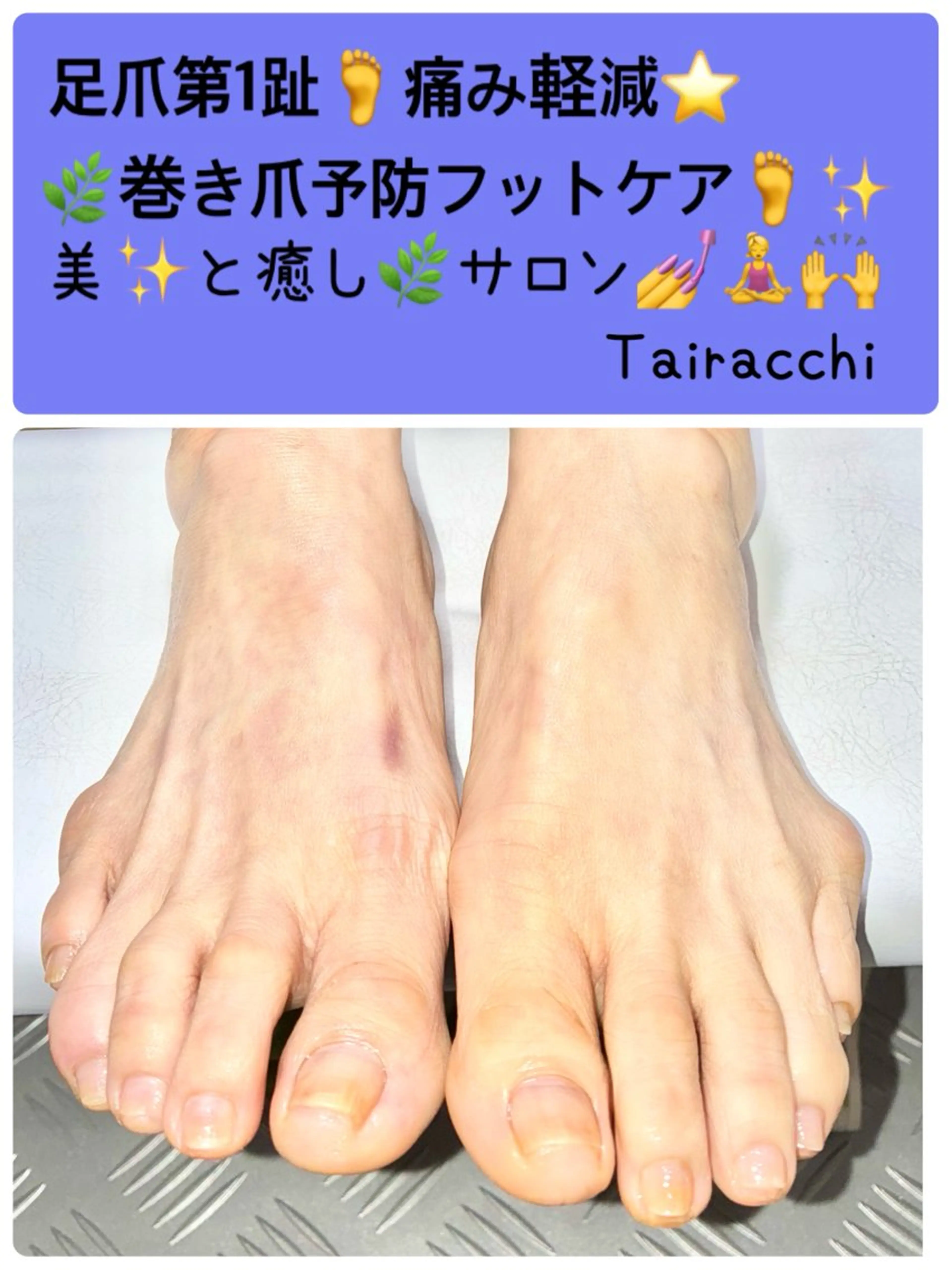 ネイル フットネイル Tairacchi ﾀｲﾗｯﾁのエステ・リラクイメージ