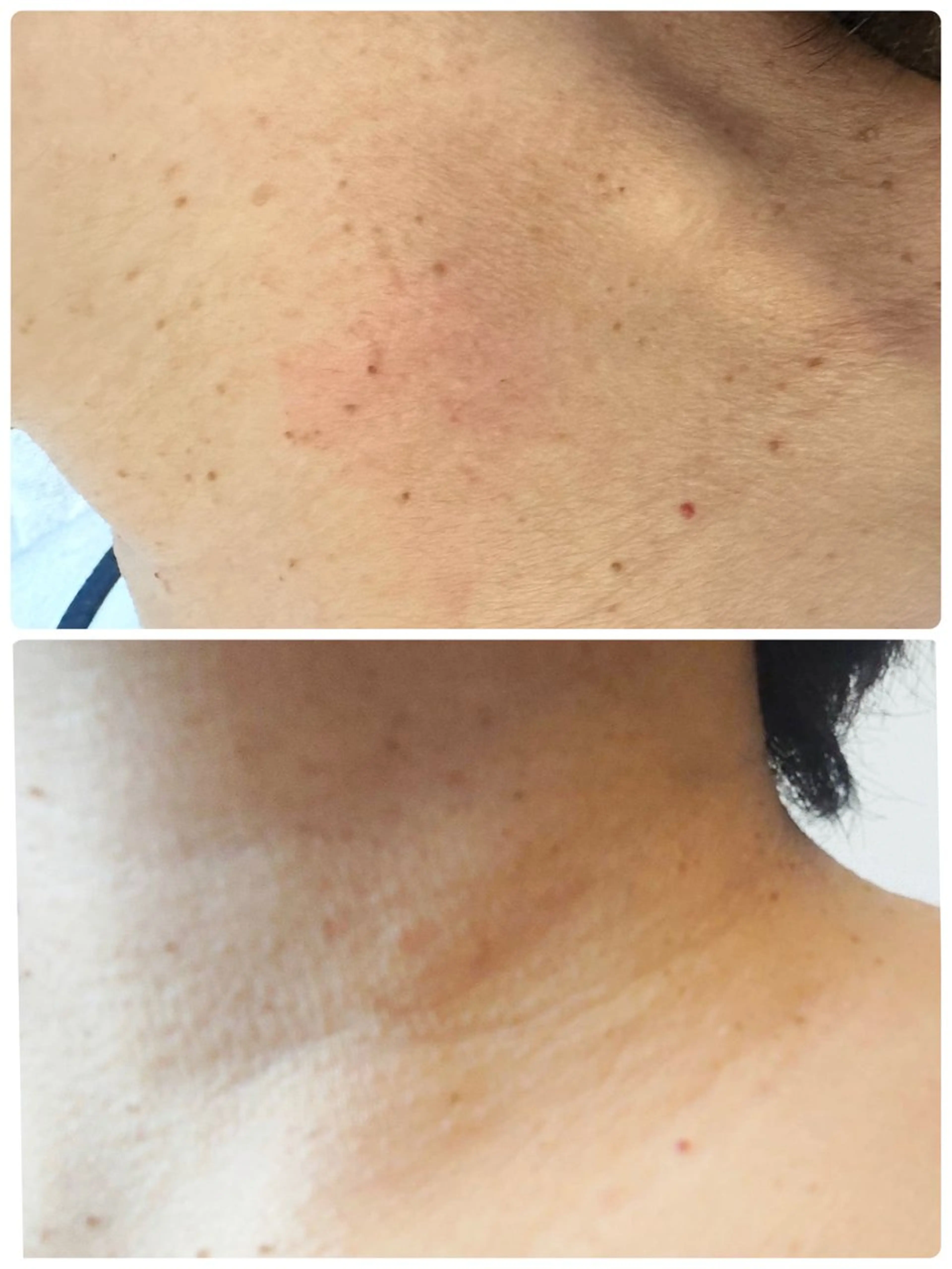 バストアップ専門/デ トックス/小顔コルギのエステ・リラクイメージ