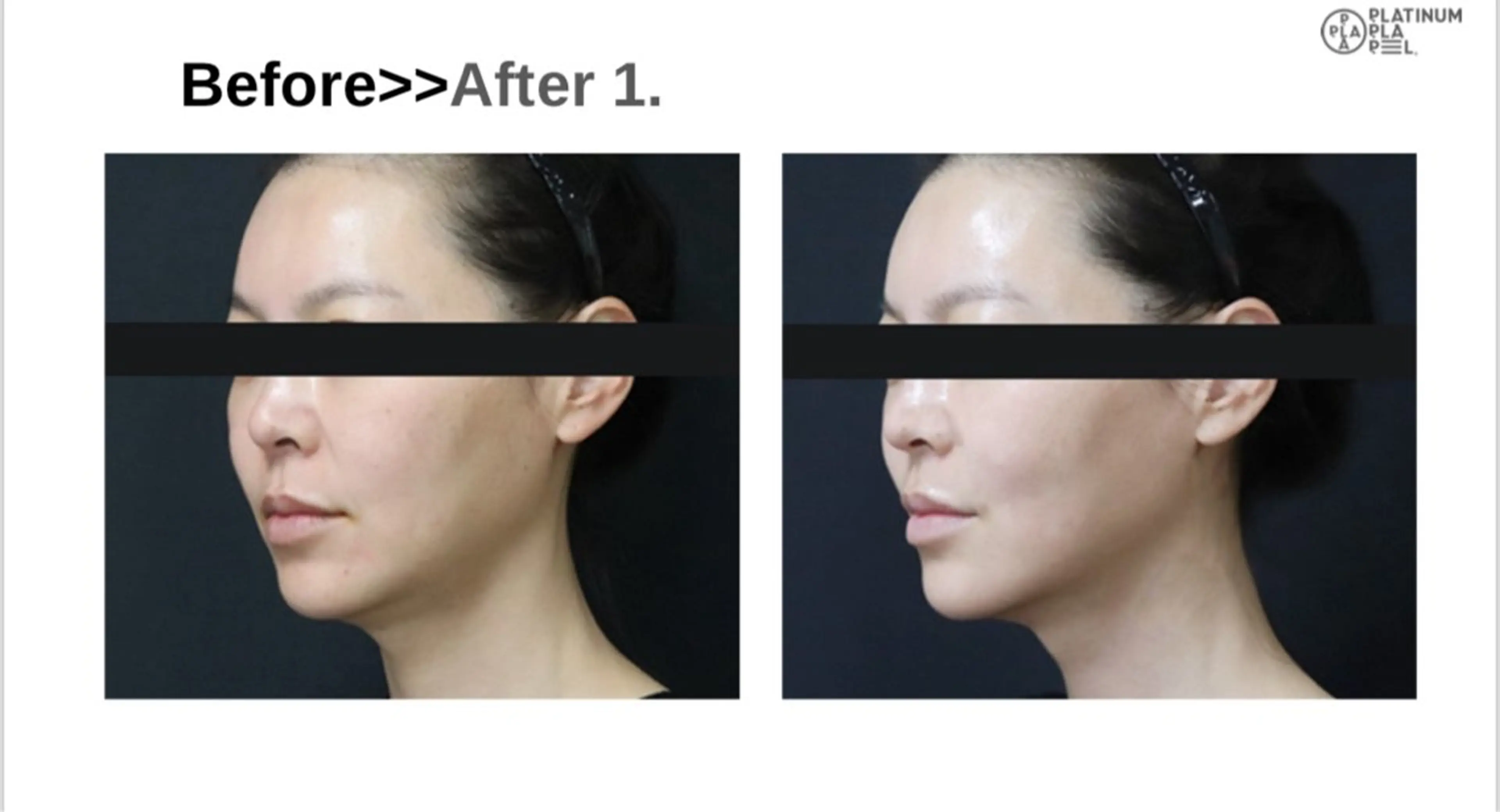 エステ 井上 静のエステ・リラクイメージ