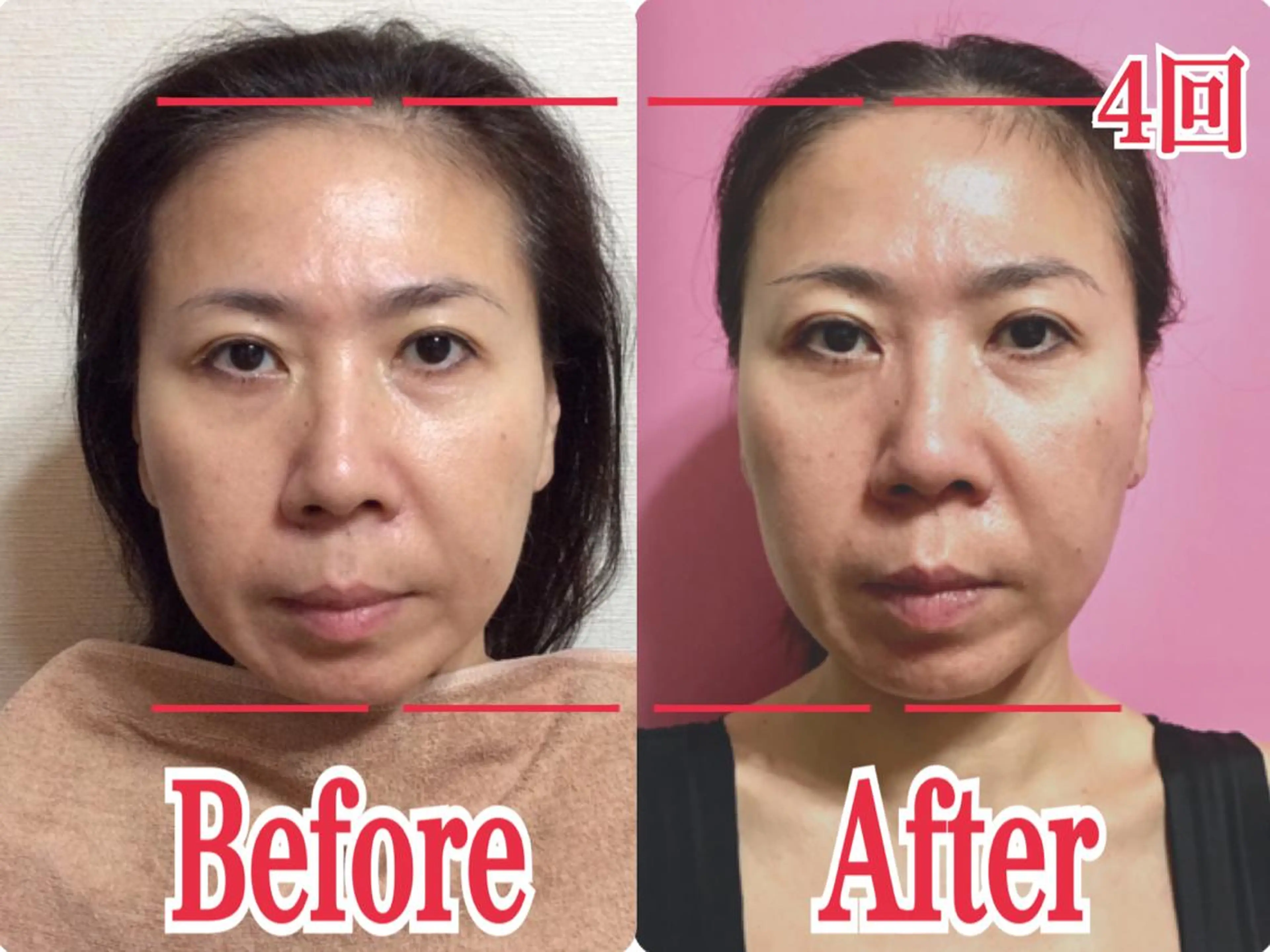 エステ 佐藤 めぐみの眉毛・アイブロウイメージ