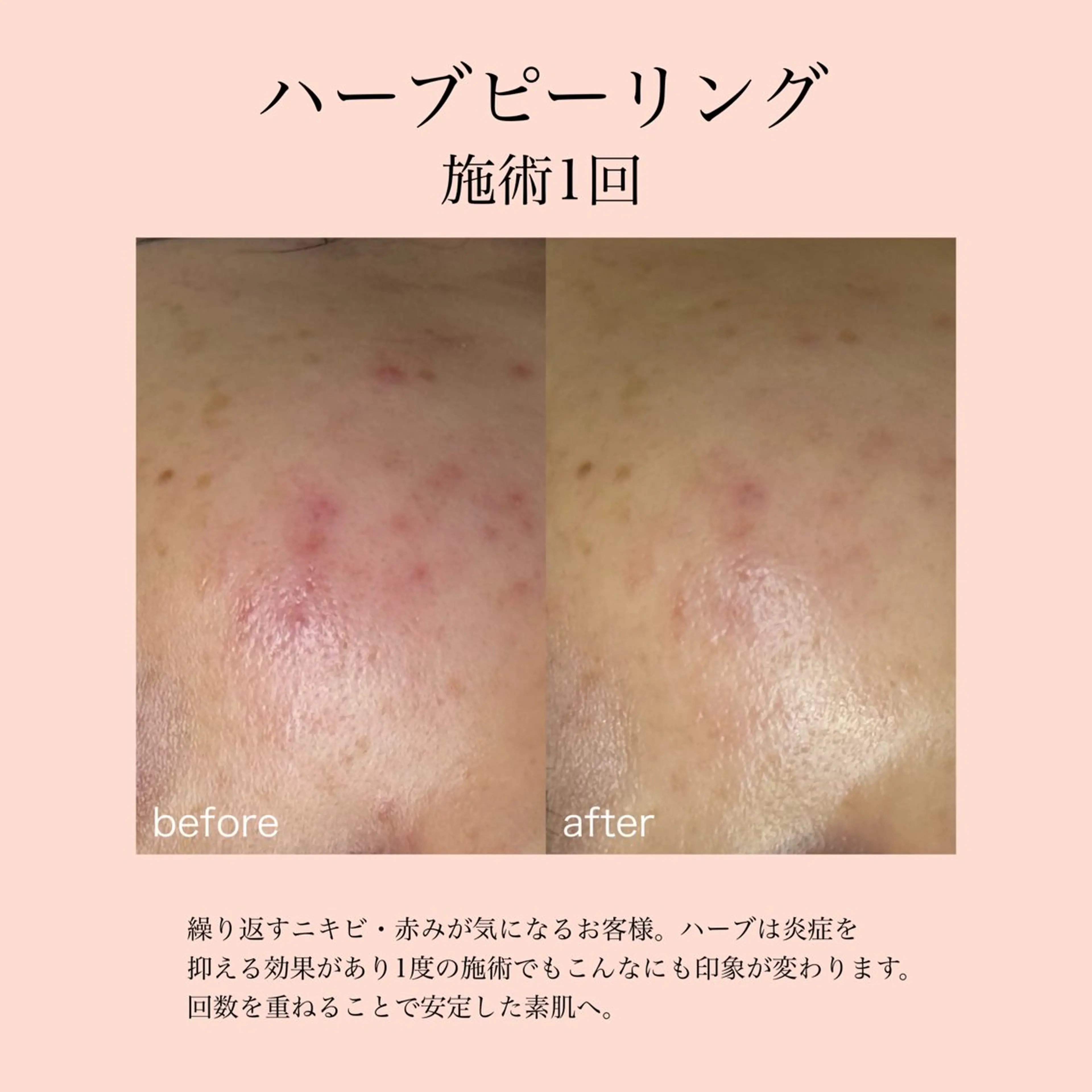 エステ Bell skin所属・肌質改善×癒しサロン Bell skinのエステ・リラクイメージ