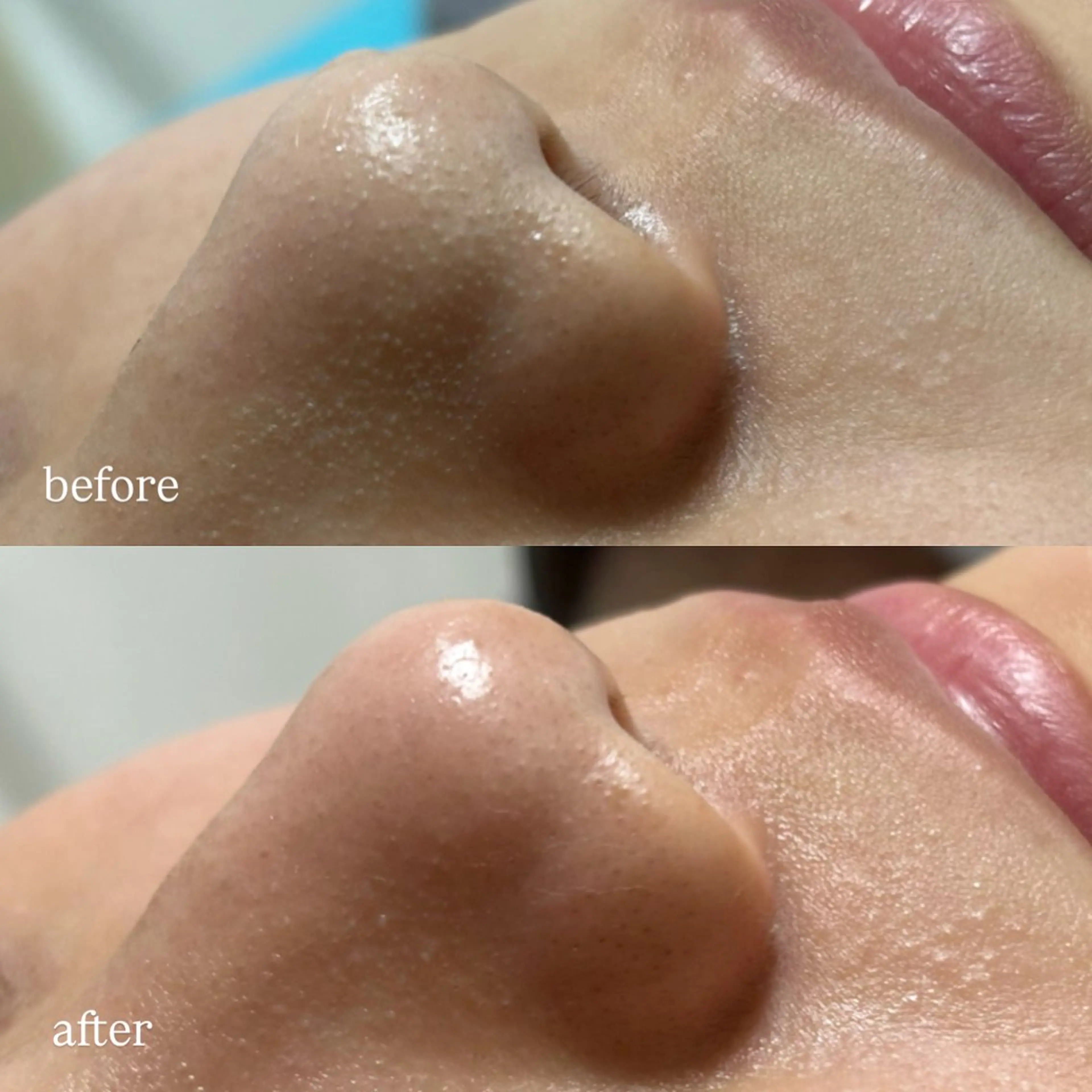 メンズ latienne kahoのエステ・リラクイメージ