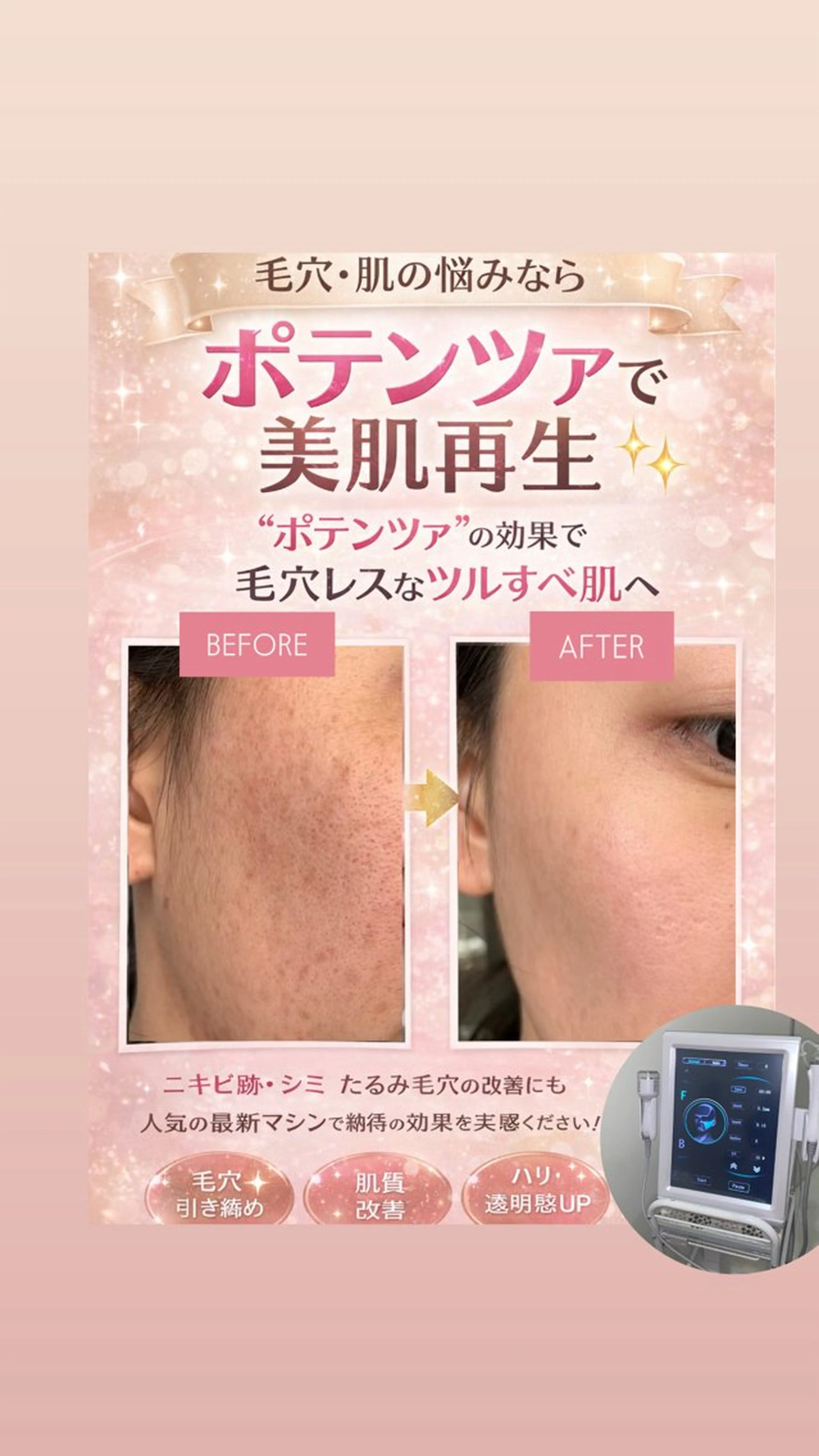 マツエク・マツパ エステ 愛維美水光美肌専門店 メンズレディースokのエステ・リラクイメージ