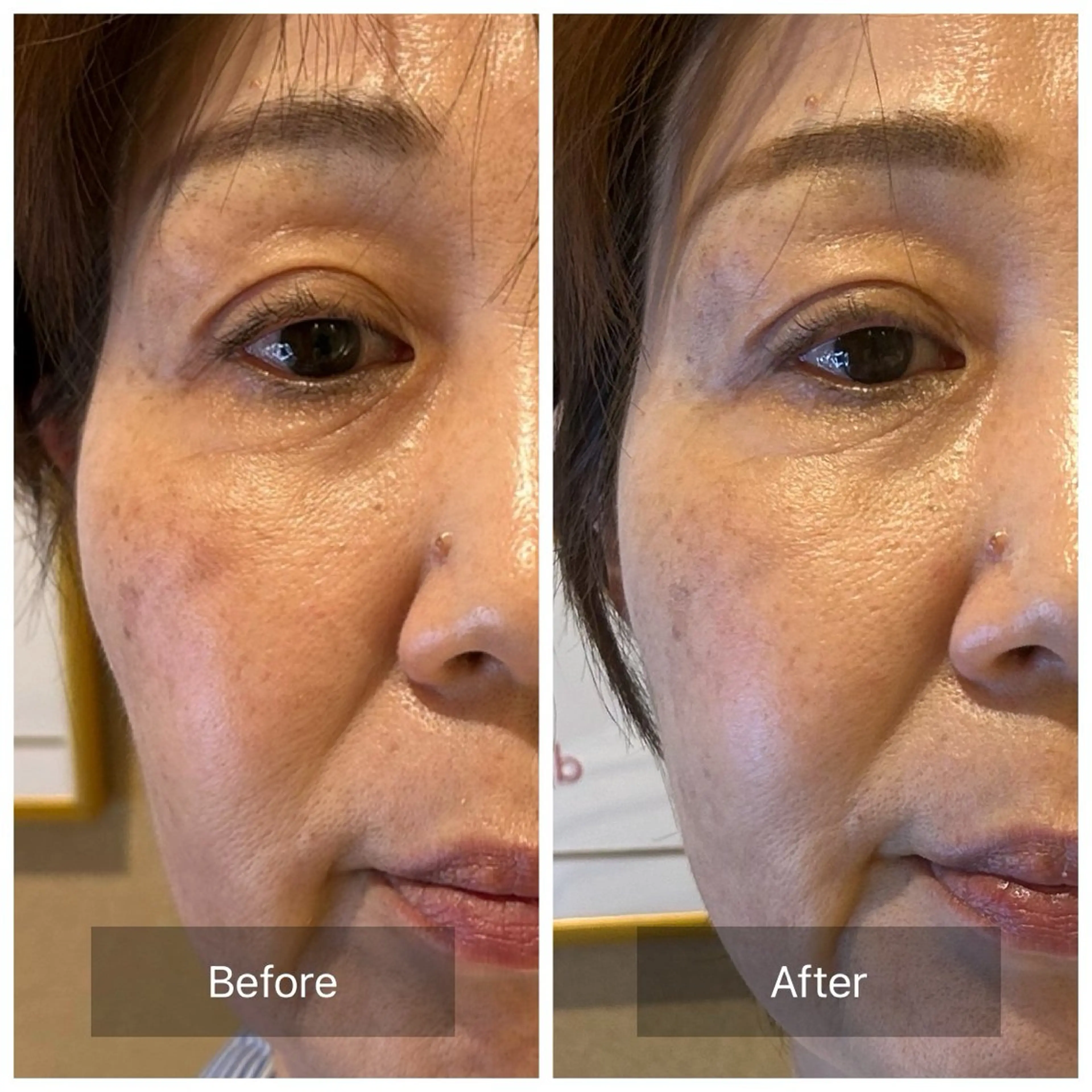 エステ mine.mi マインエムのエステ・リラクイメージ