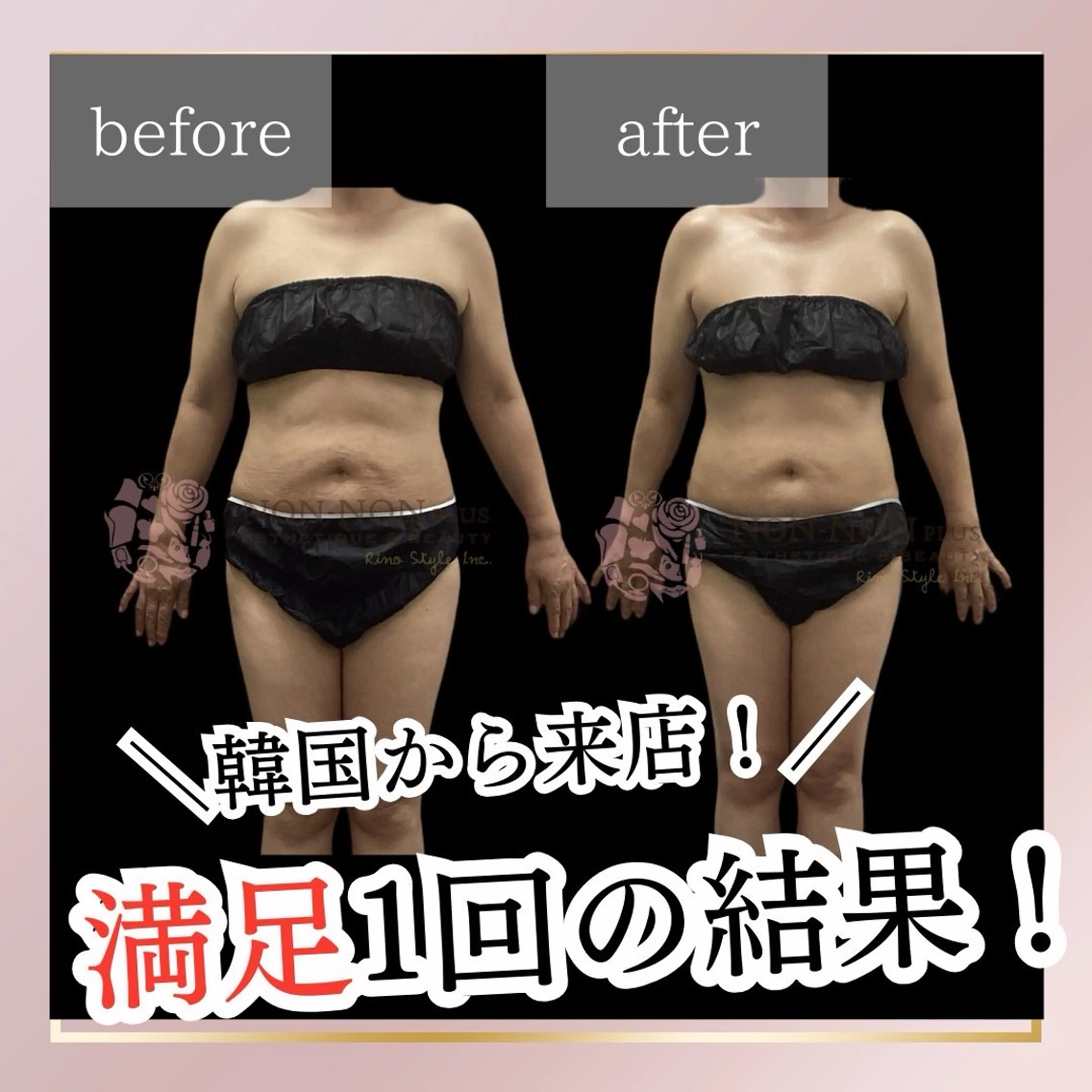 エステ リラク NON-NONプラス 大人の本気痩身のエステ・リラクイメージ