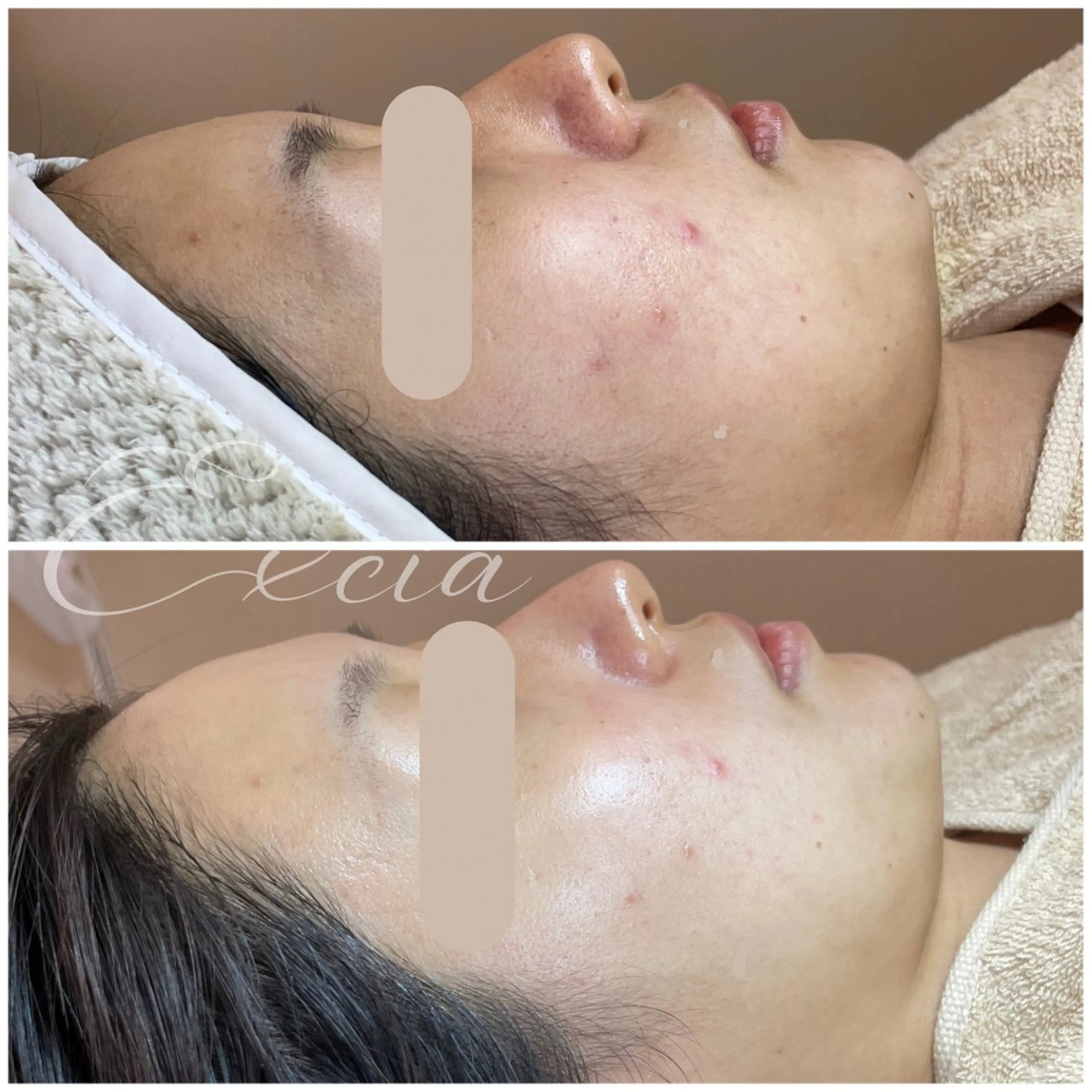 EXCIA所属・EXCIA (エクシア)のエステ・リラクイメージ