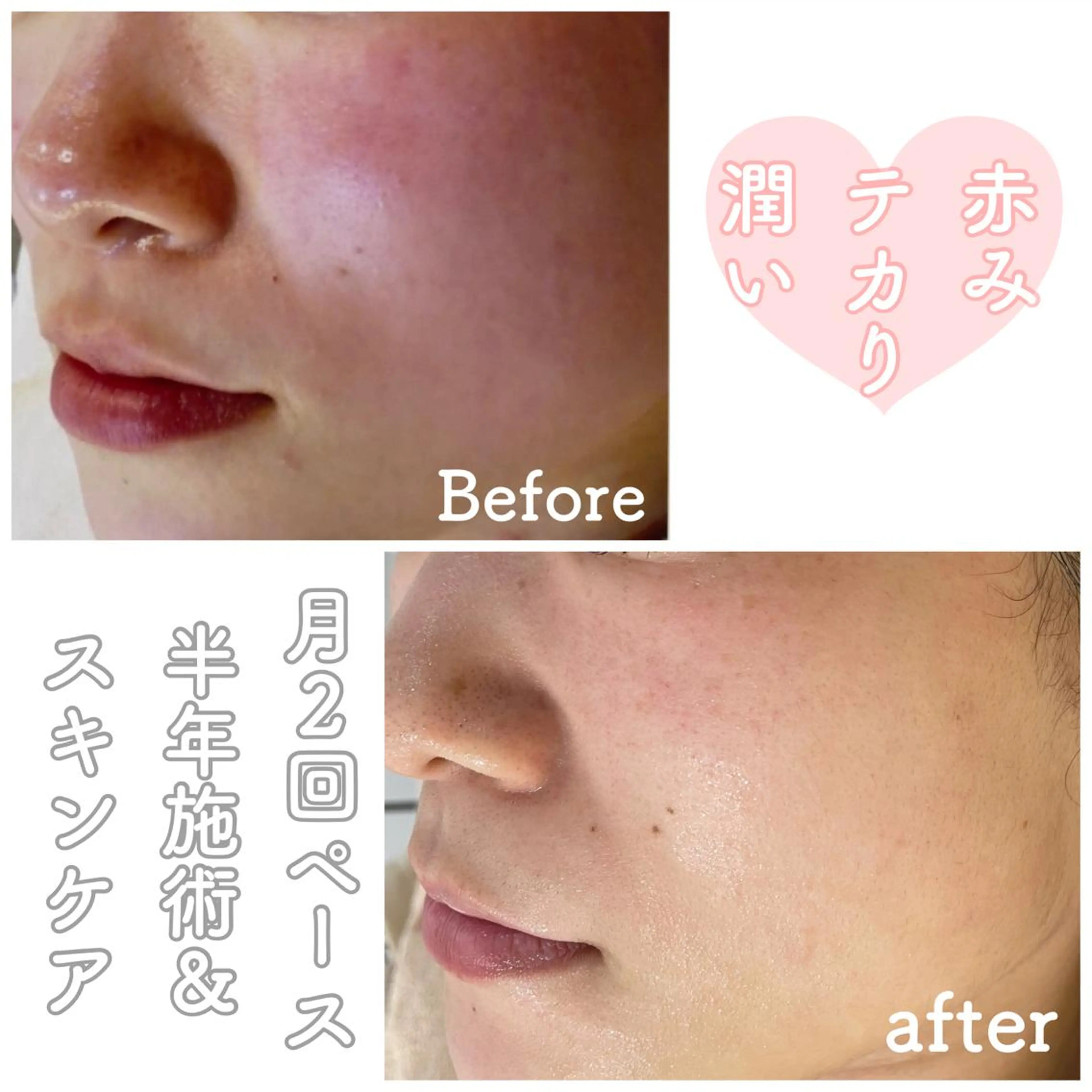 ショート カラー パーマ ヘアアレンジ メンズ キッズ ネイル マツエク・マツパ 赤色 エステ ニキビ&跡改善サロン オーナー光木のエステ・リラクイメージ