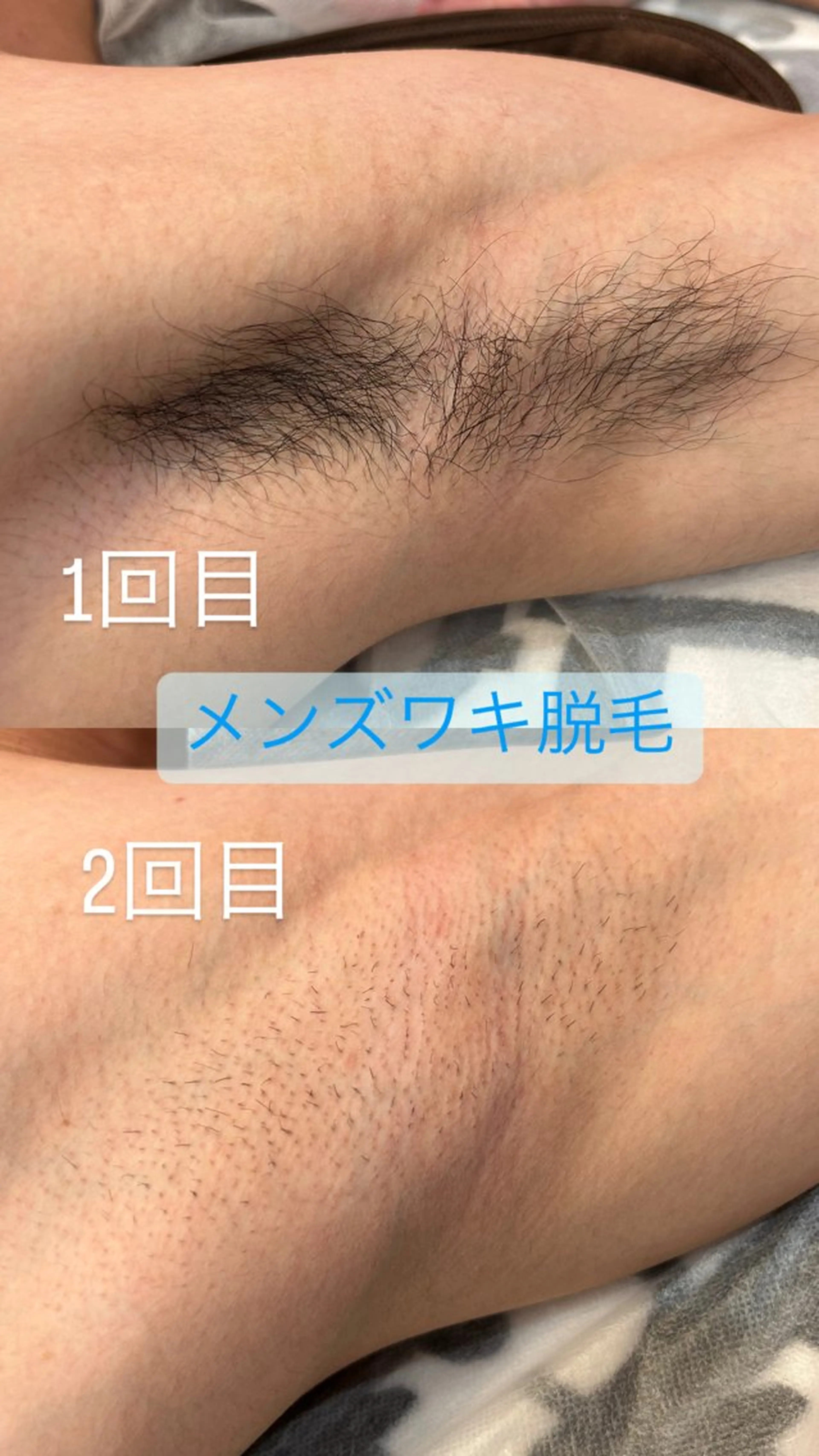 WAX・肌質改善・毛 穴洗浄/林愛真のエステ・リラクイメージ