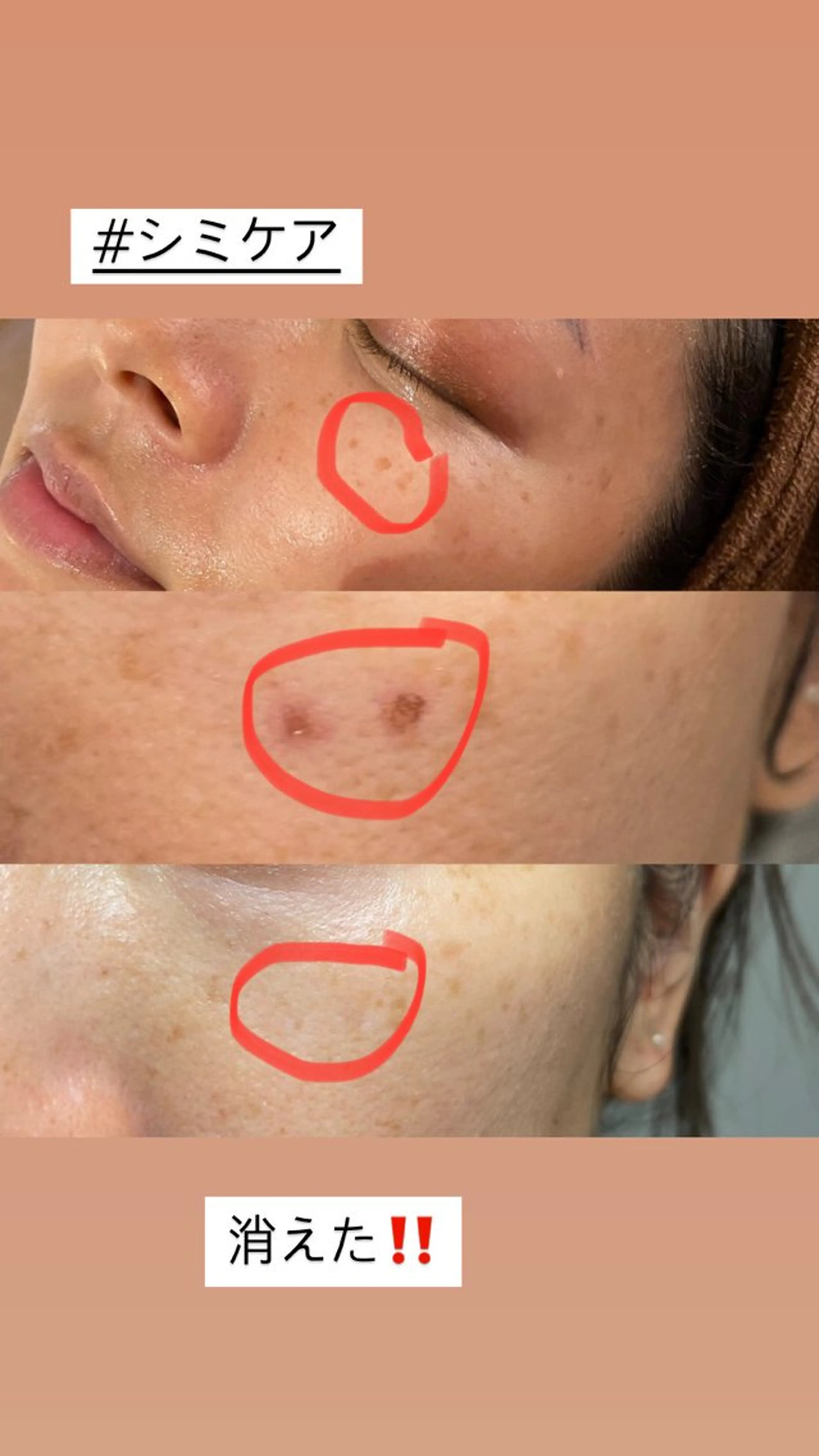 Meetite 小林のエステ・リラクイメージ