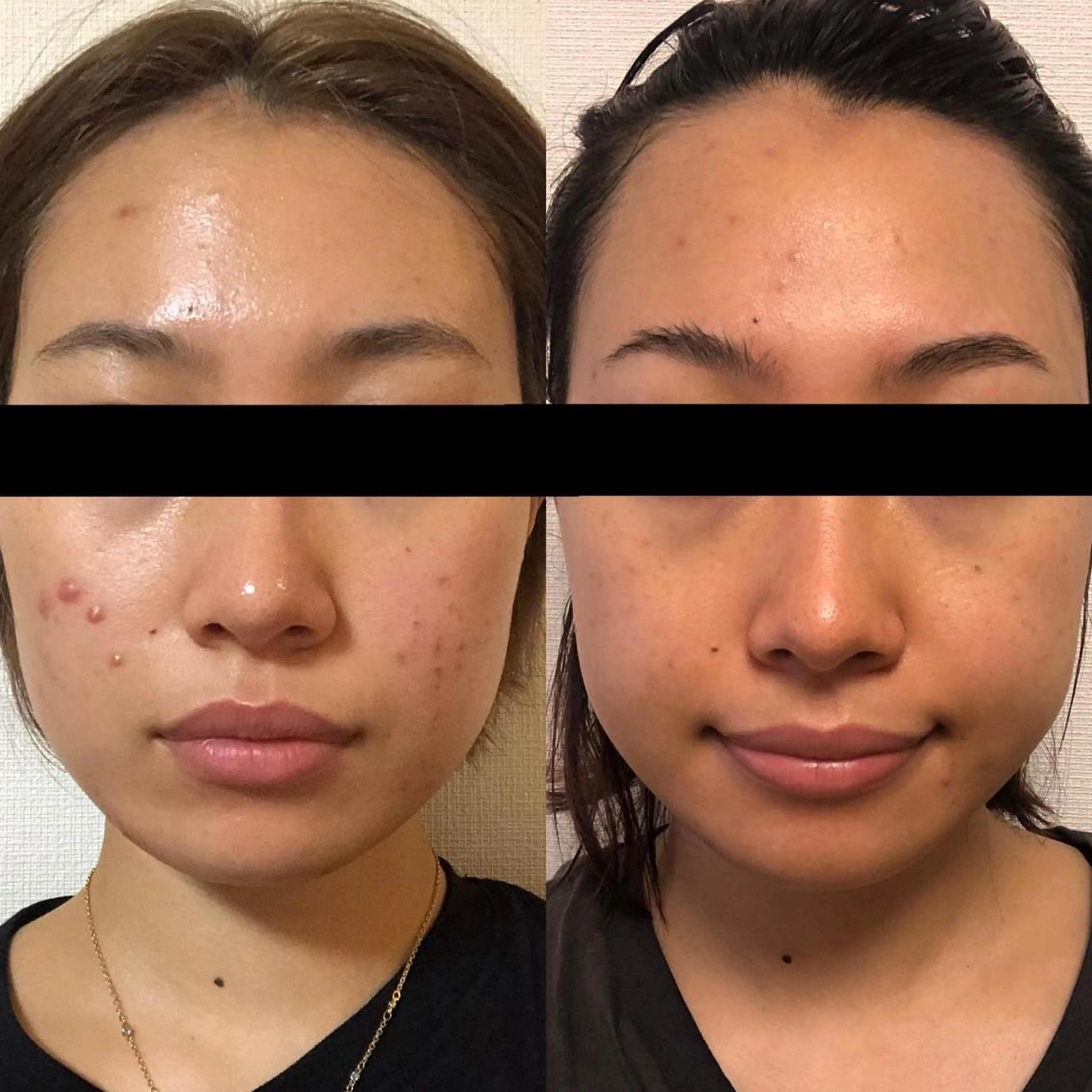 朝重い人専用 肩甲骨調整のエステ・リラクイメージ