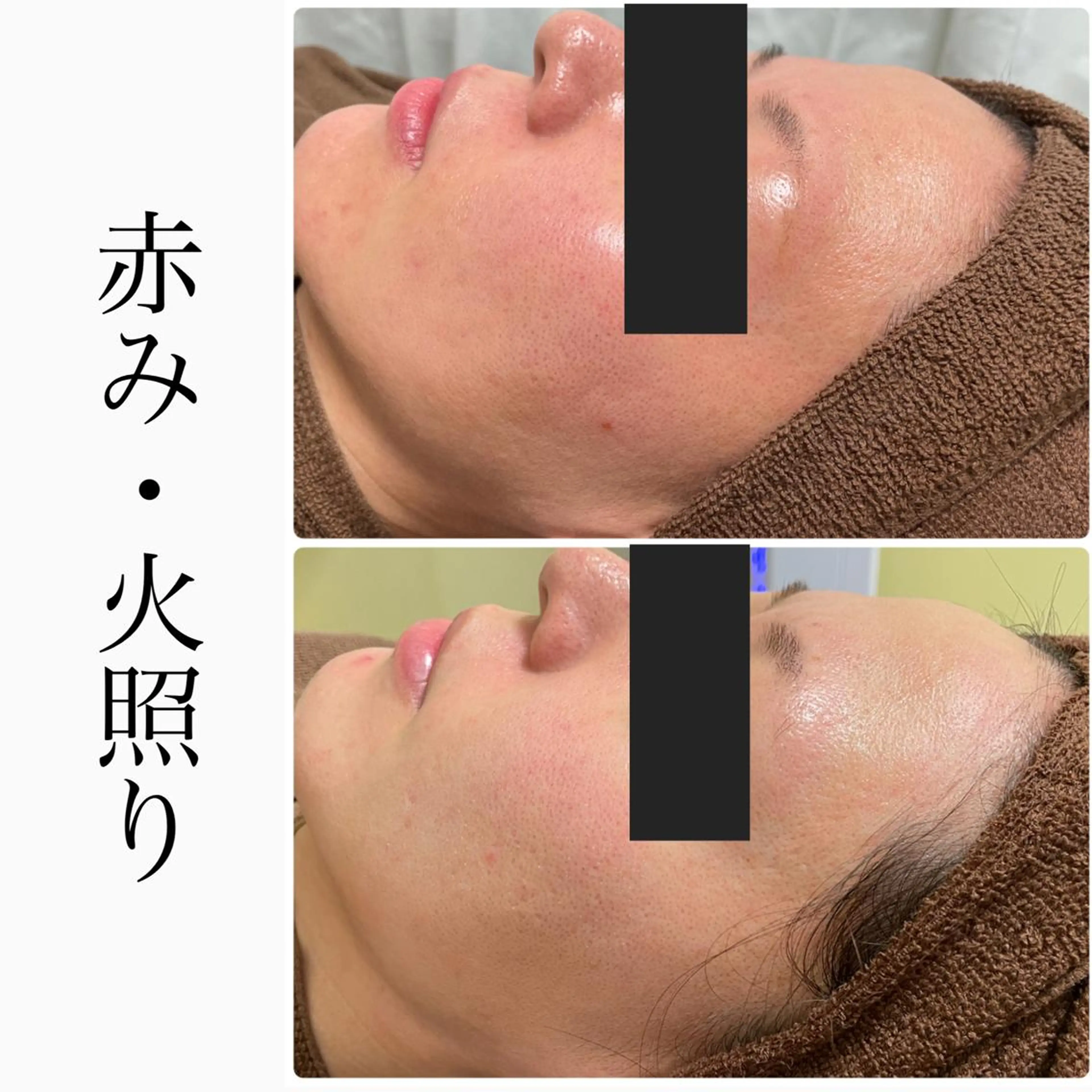 エステ ハーブピーリング専門 BIOEL横浜のエステ・リラクイメージ