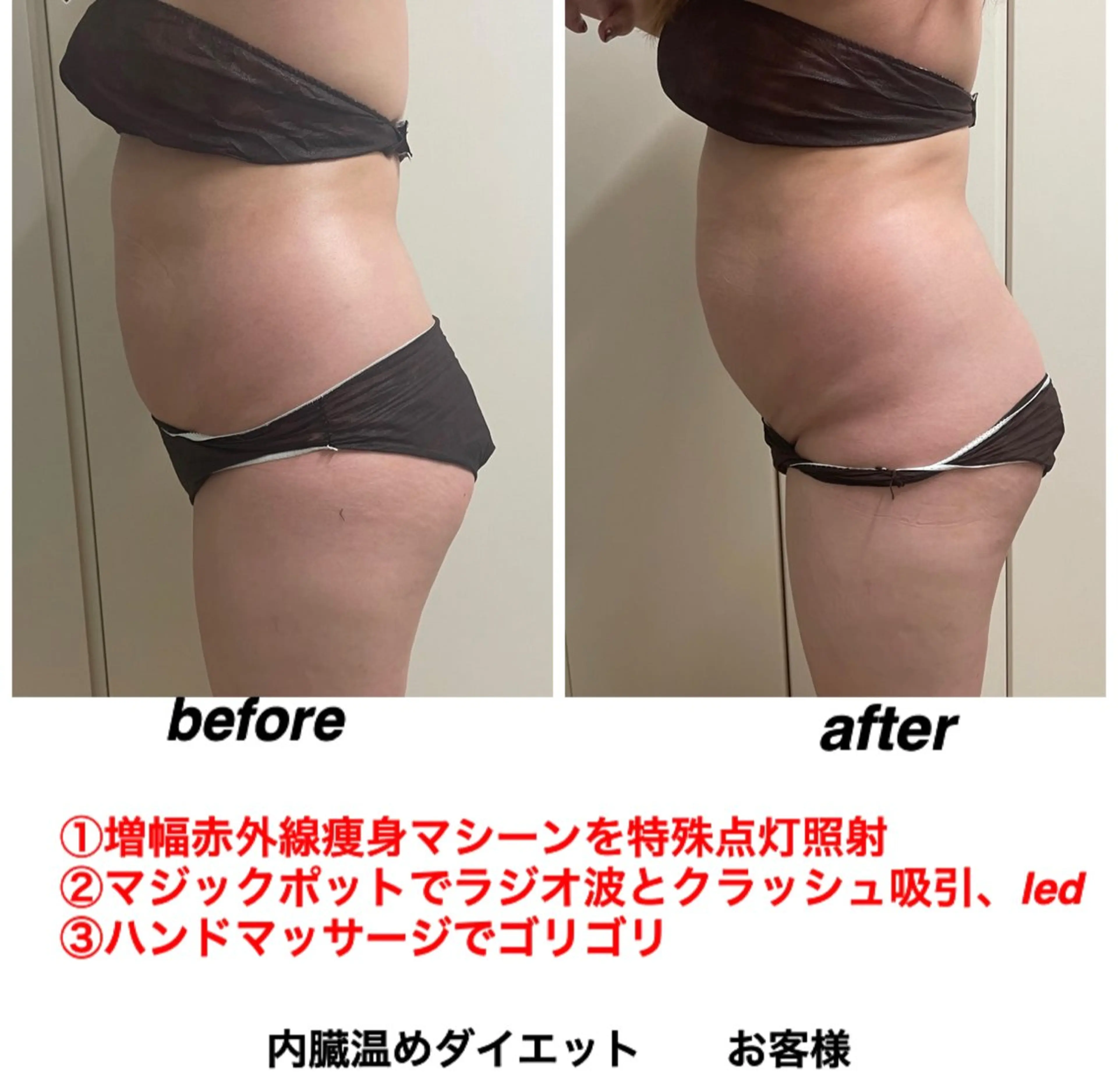 エステ ネイル・エステサロン UILANIのネイルデザイン