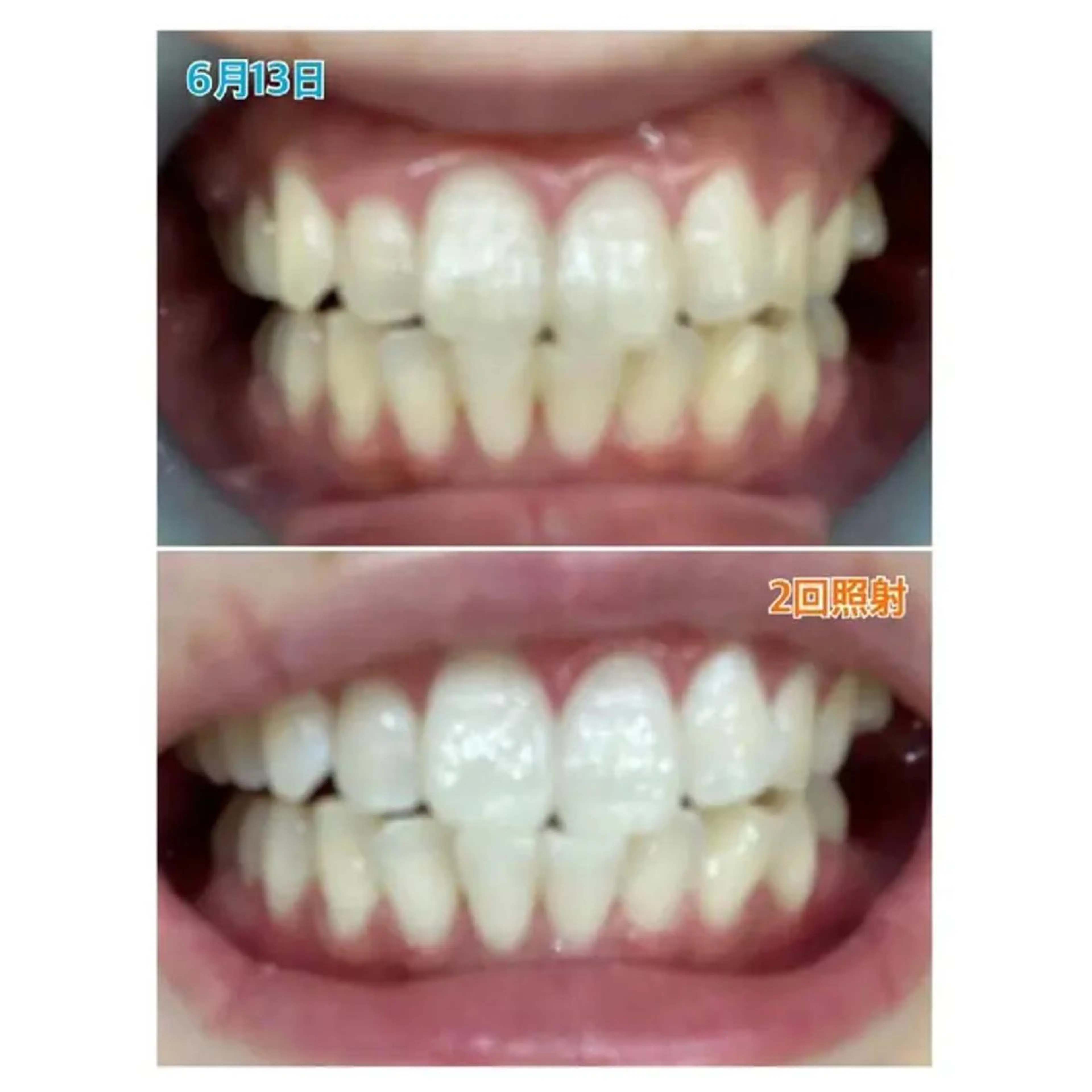 Ｍ渋谷 ホワイトニングのエステ・リラクイメージ