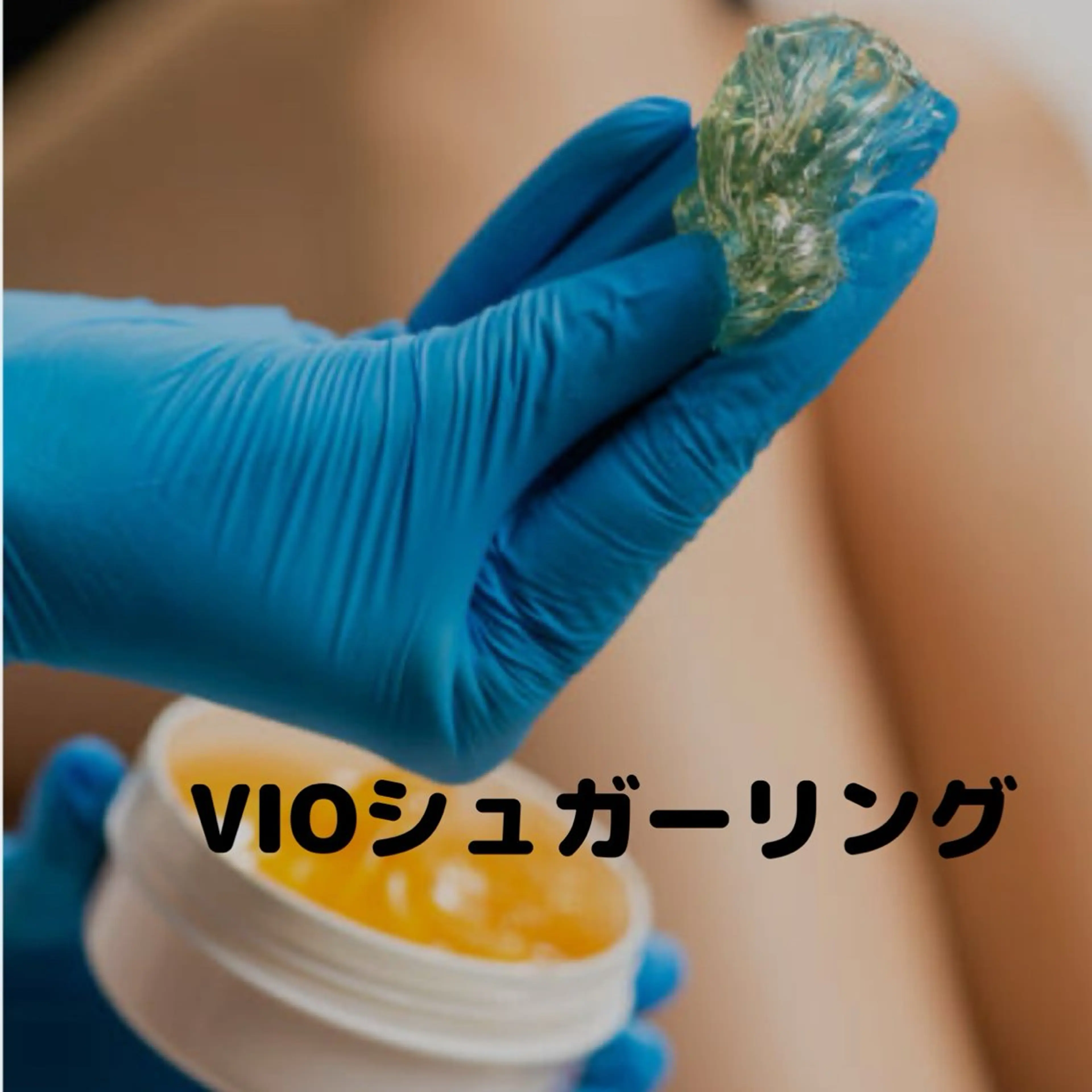 VIOシュガーリングの写真