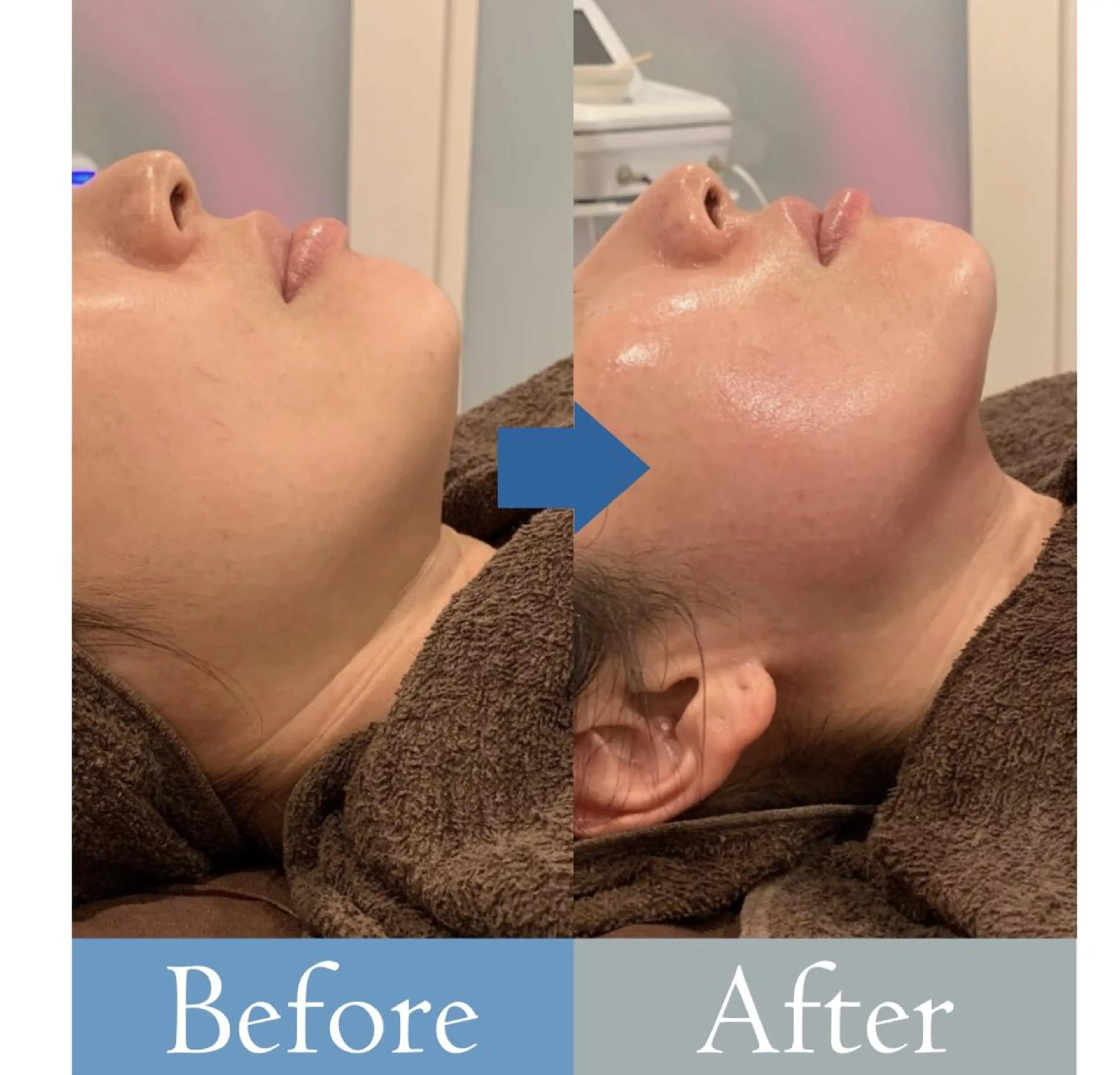 Crescent Beautyのエステ・リラクイメージ