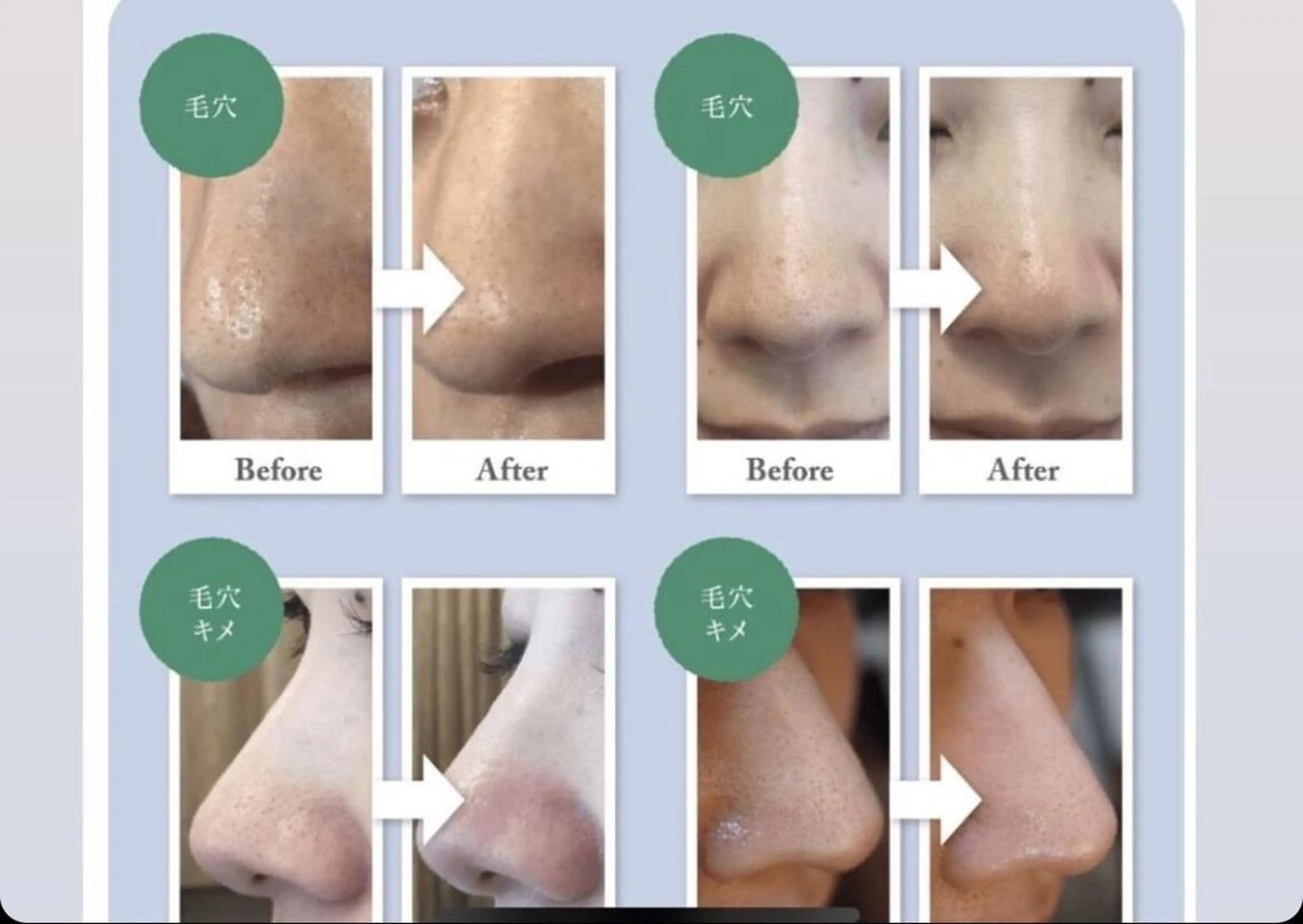 ハーブ🌿小顔❤ 海老名💎大西玲子のエステ・リラクイメージ