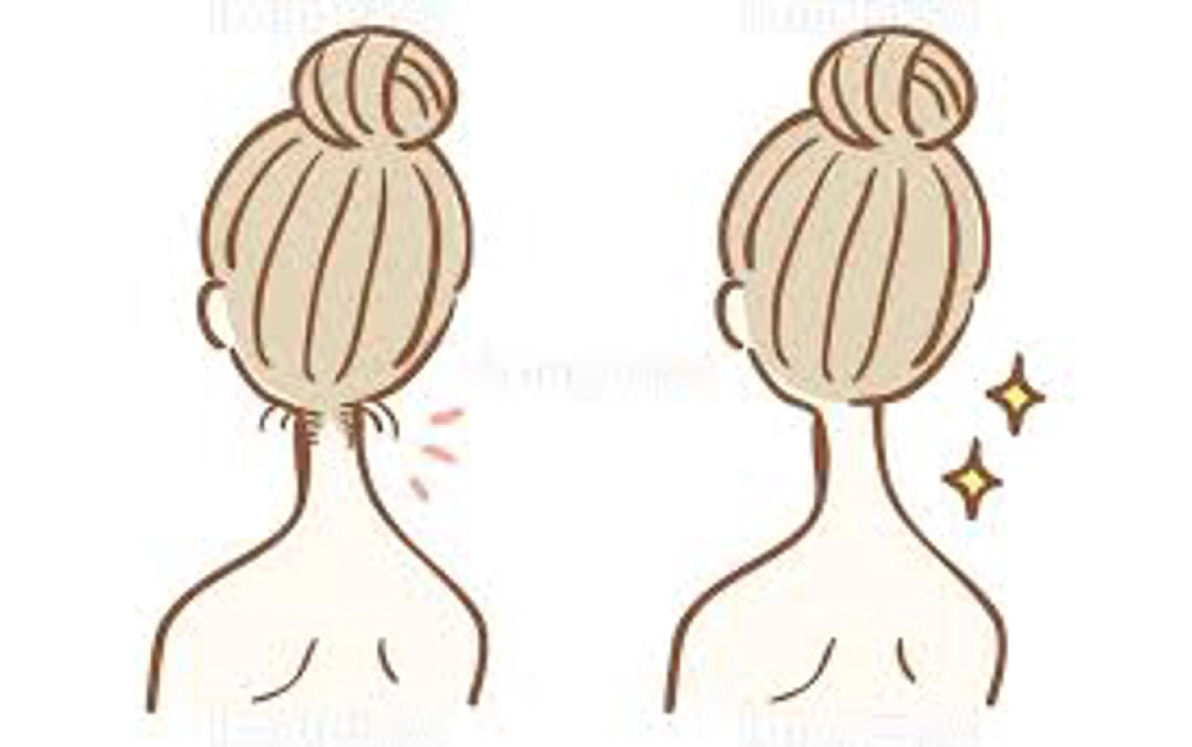 ⭐️ミニモ限定⭐️最新美肌脱毛 《うなじ》の写真