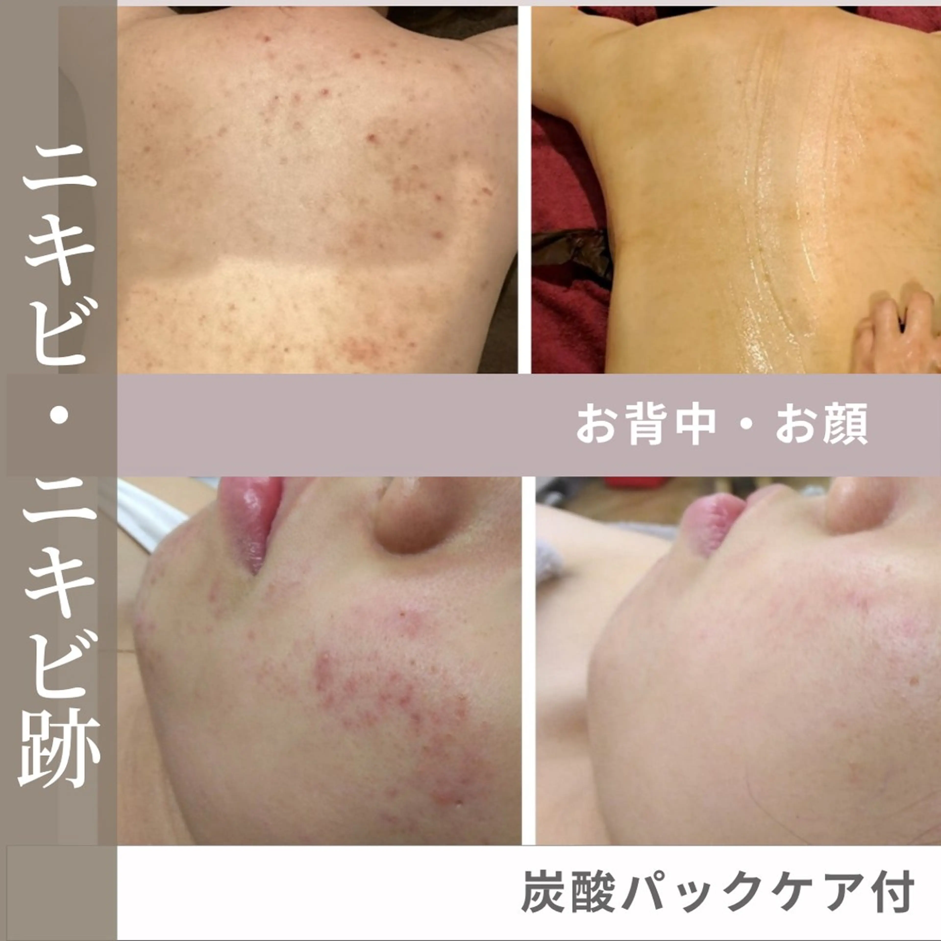 井上 みあのエステ・リラクイメージ