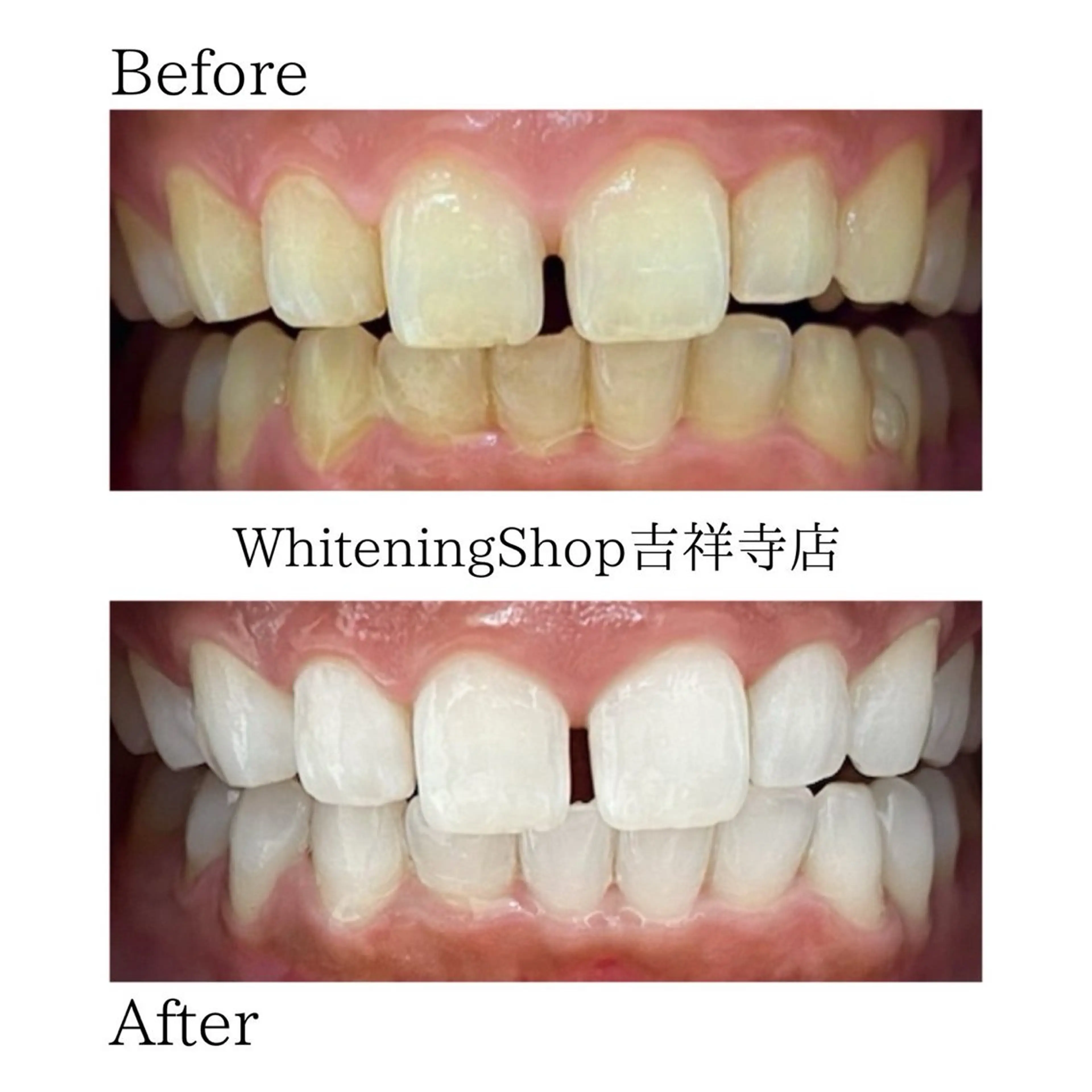 エステ リラク ホワイトニング ショップ吉祥寺店のエステ・リラクイメージ