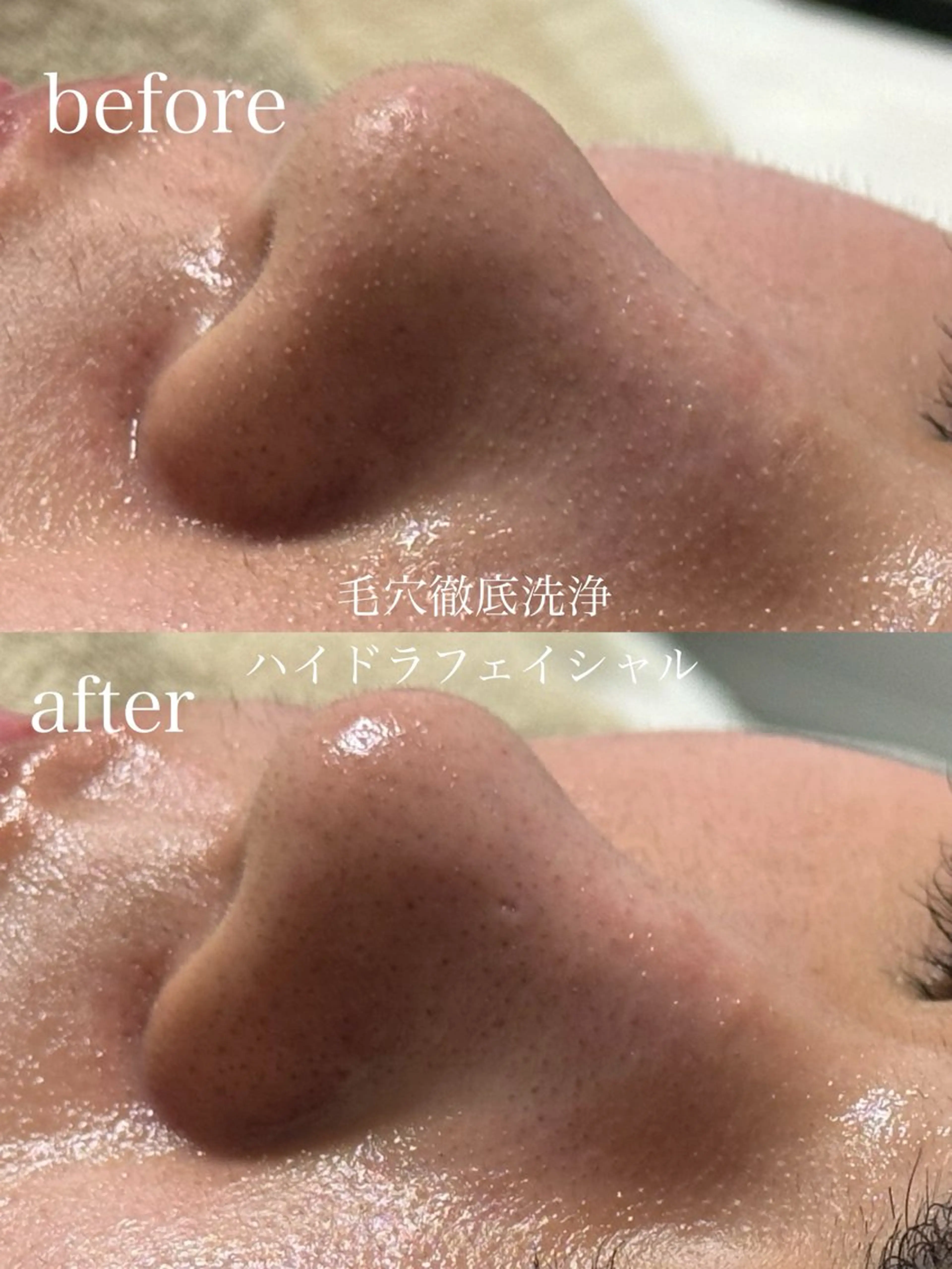 エステ フェイシャルサロン CHIARA鈴木のエステ・リラクイメージ