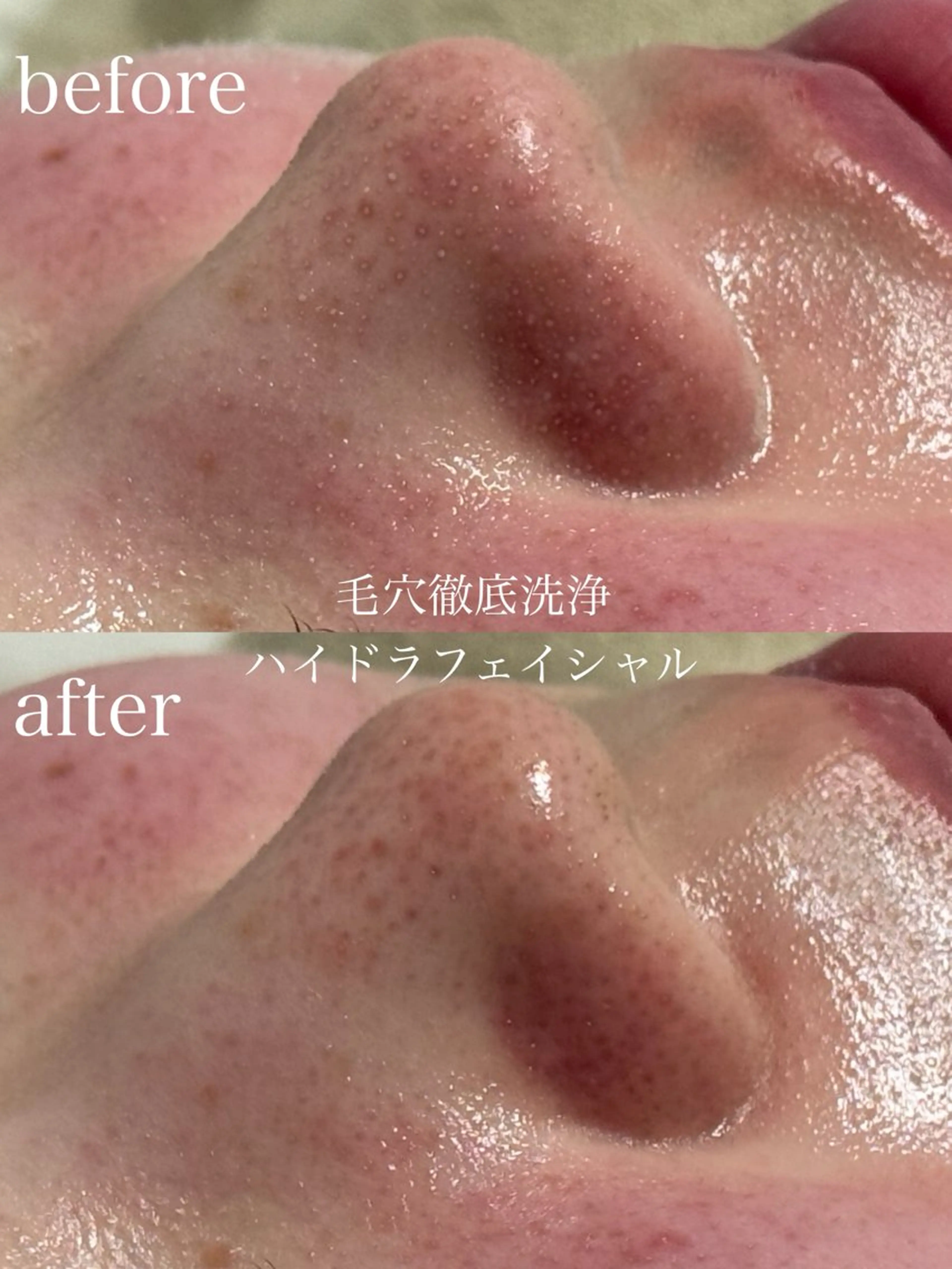 エステ フェイシャルサロン CHIARA鈴木のエステ・リラクイメージ