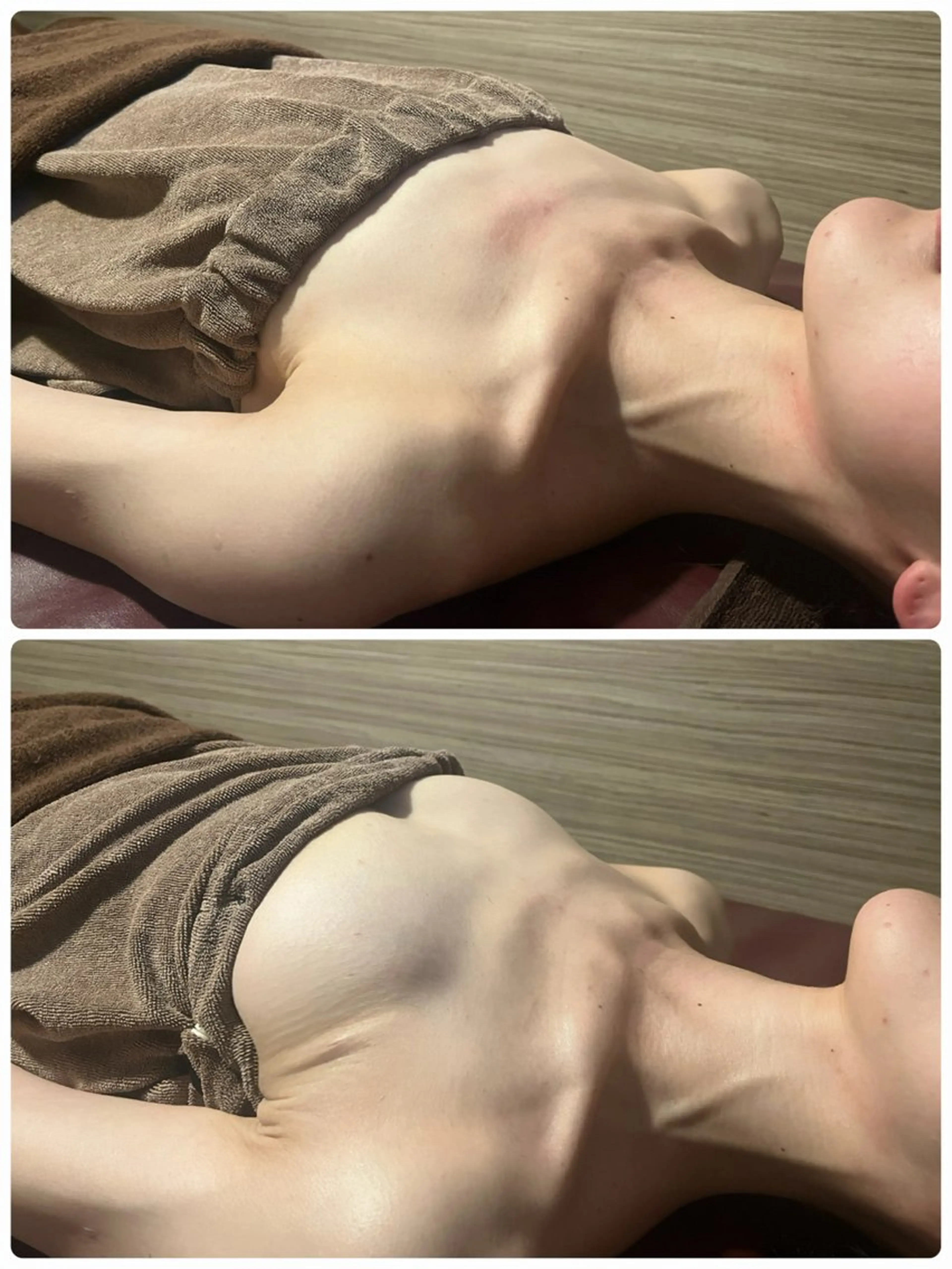 《新規ミニモ限定🌸》流れた脂肪を寄せあげ❤️🔥バストアップ×背中痩身✨光豊胸バストアップコース/施術60分の写真