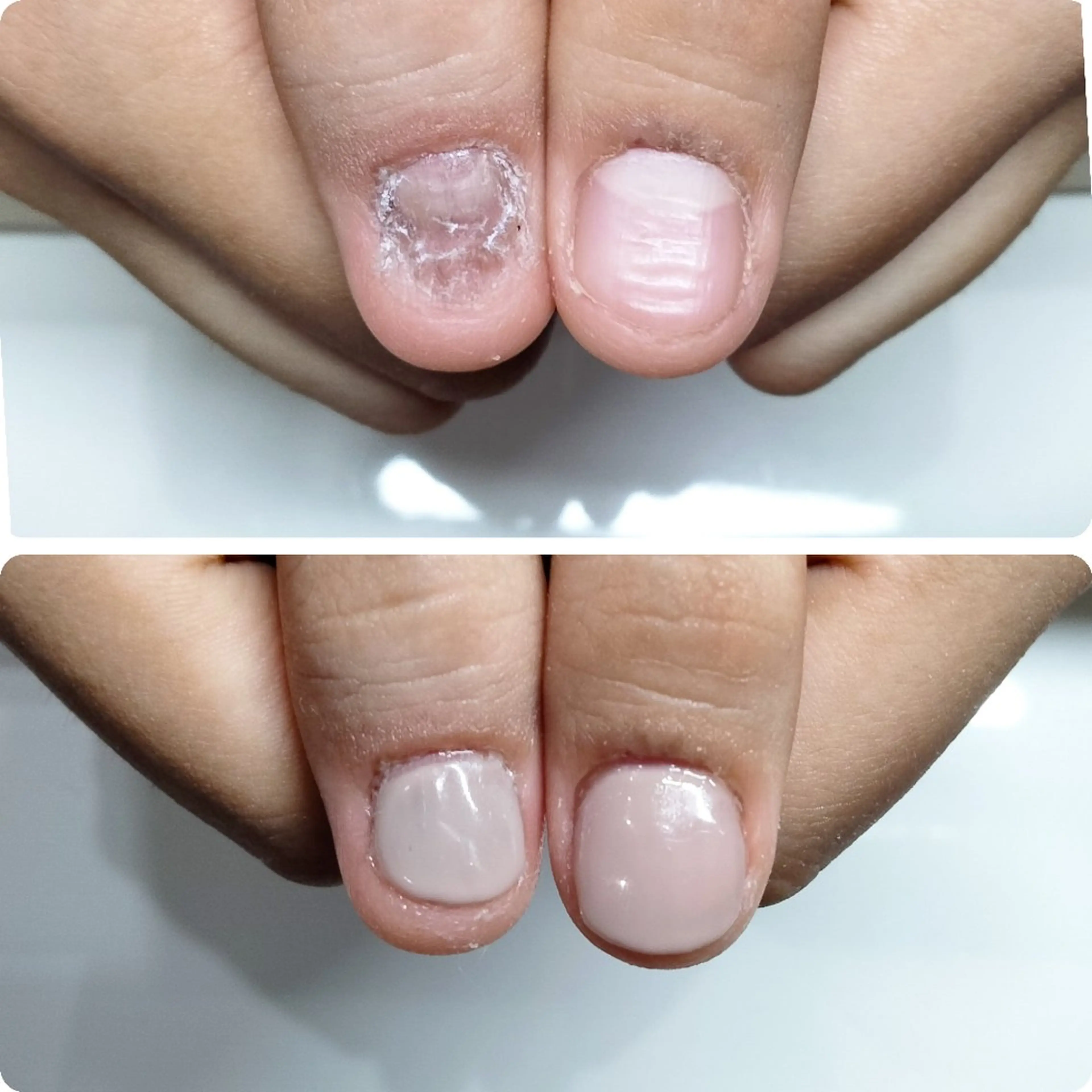 ネイル ネイルサロンアリューム所属・ネイルサロン アリュームのネイルデザイン