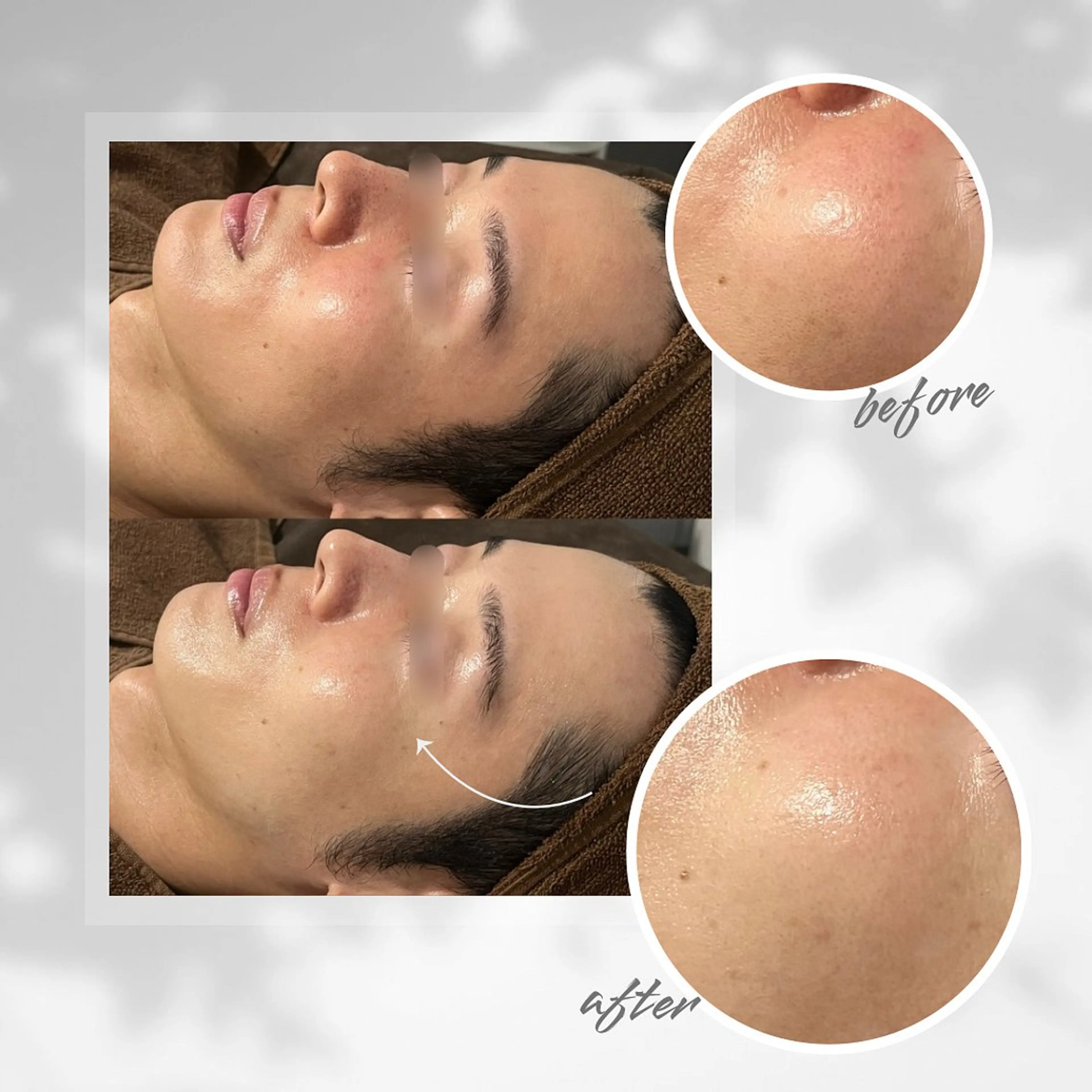 ENCHANT Kaede/肌質改善のその他イメージ