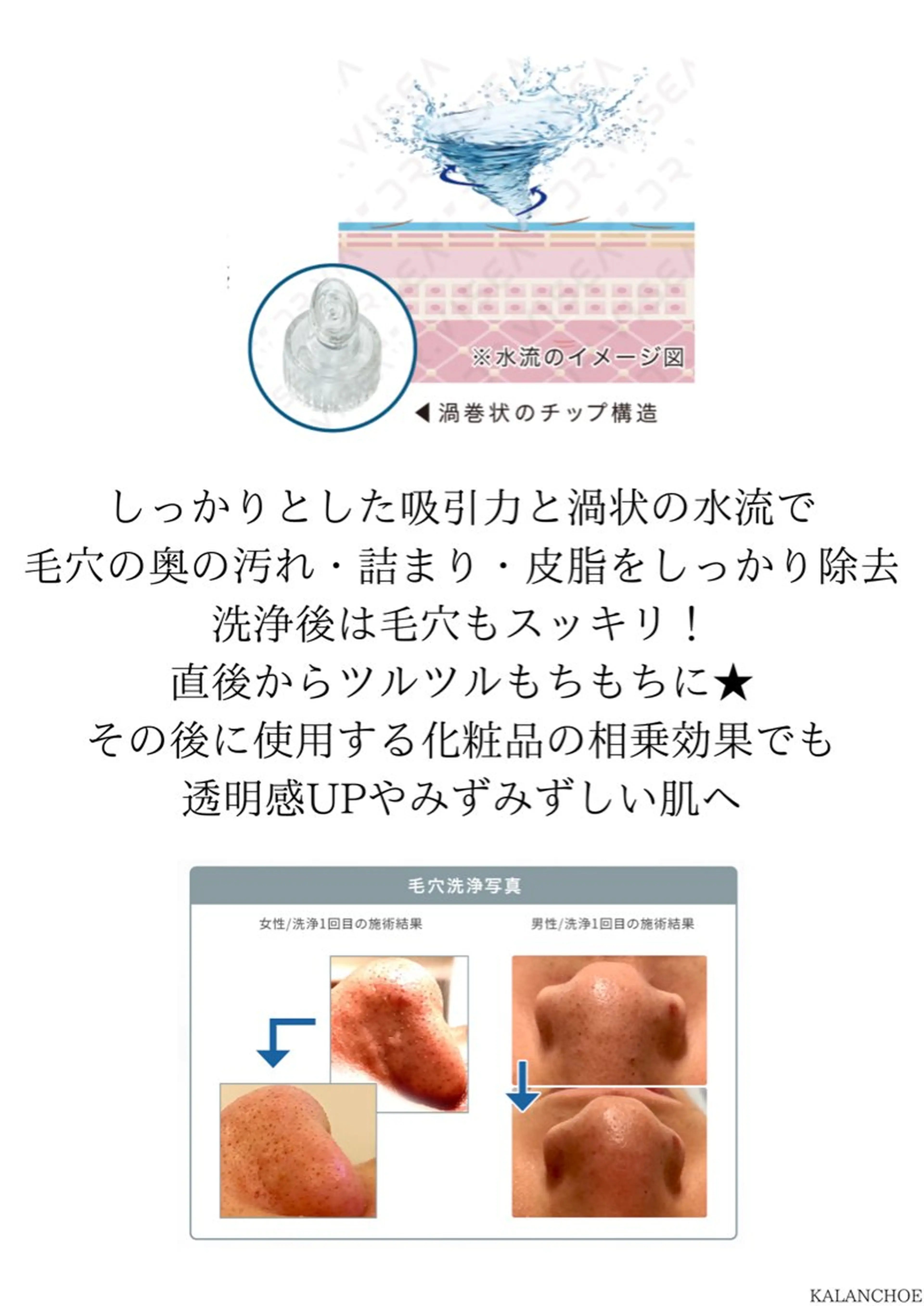 エステ リラク 肌質改善 KALANCHOEのエステ・リラクイメージ