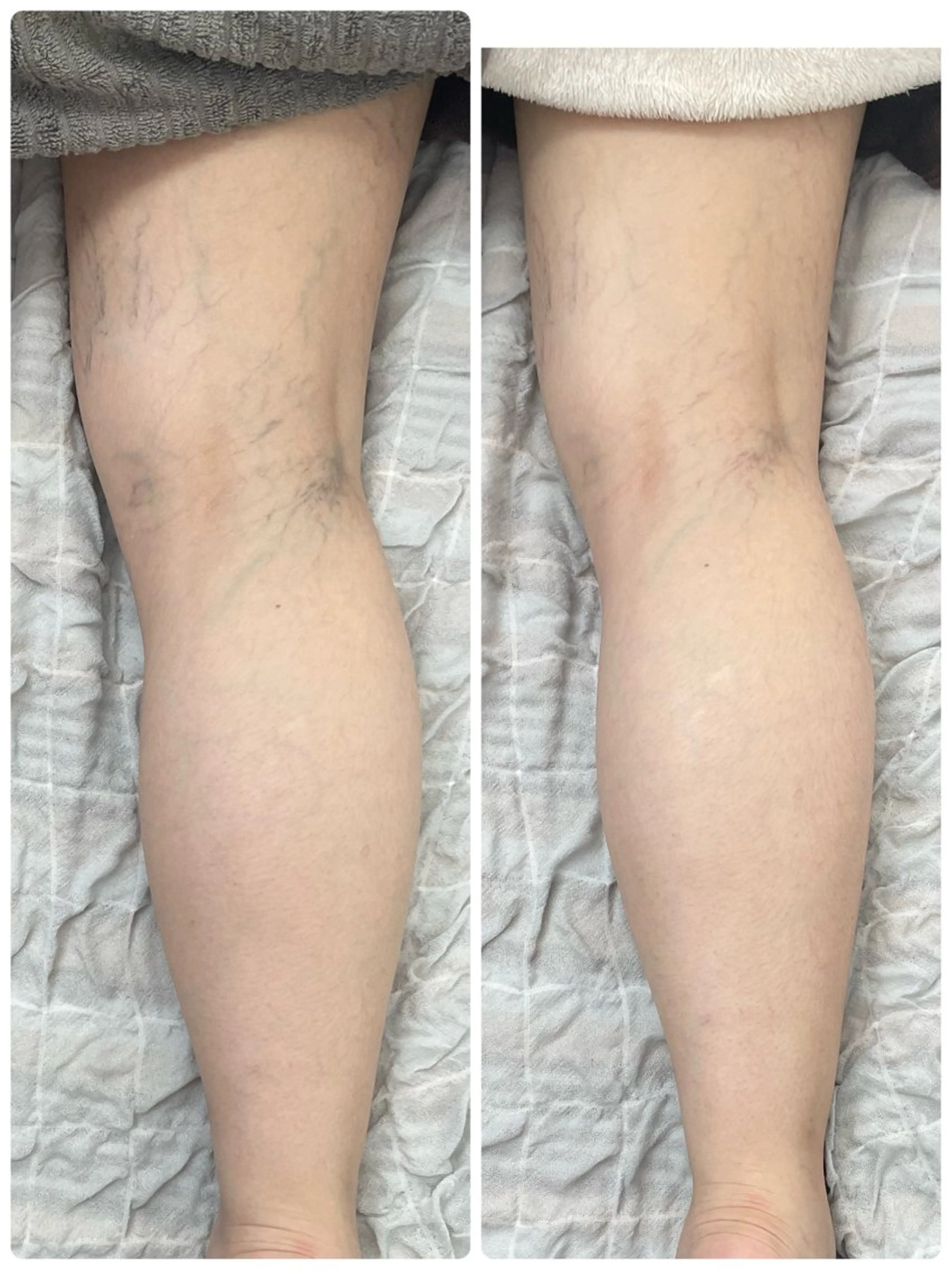 Salon Rion所属・Rion 野々村のエステ・リラクイメージ