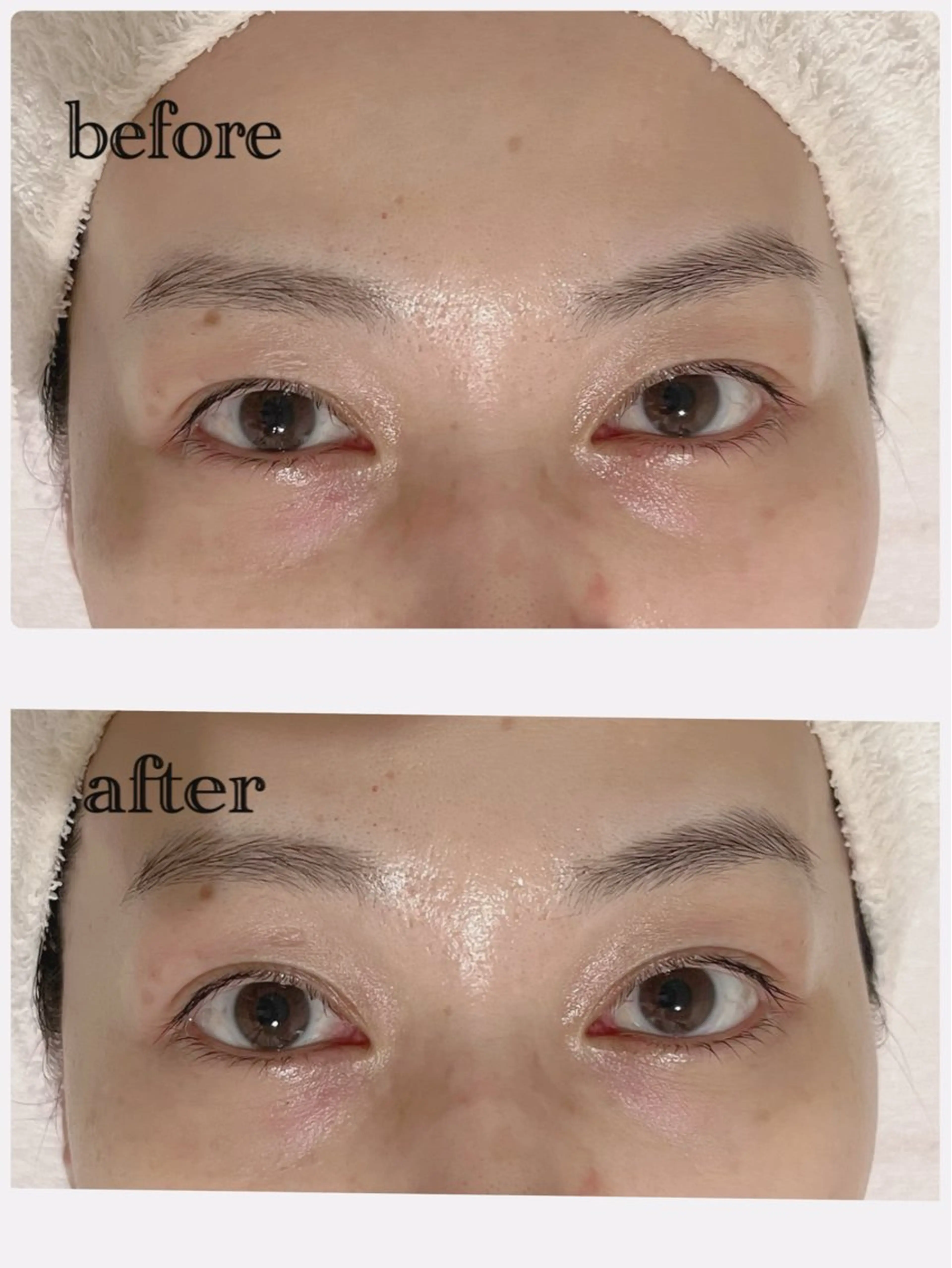 肌管理🌿毛穴改善 POLA堺東のエステ・リラクイメージ