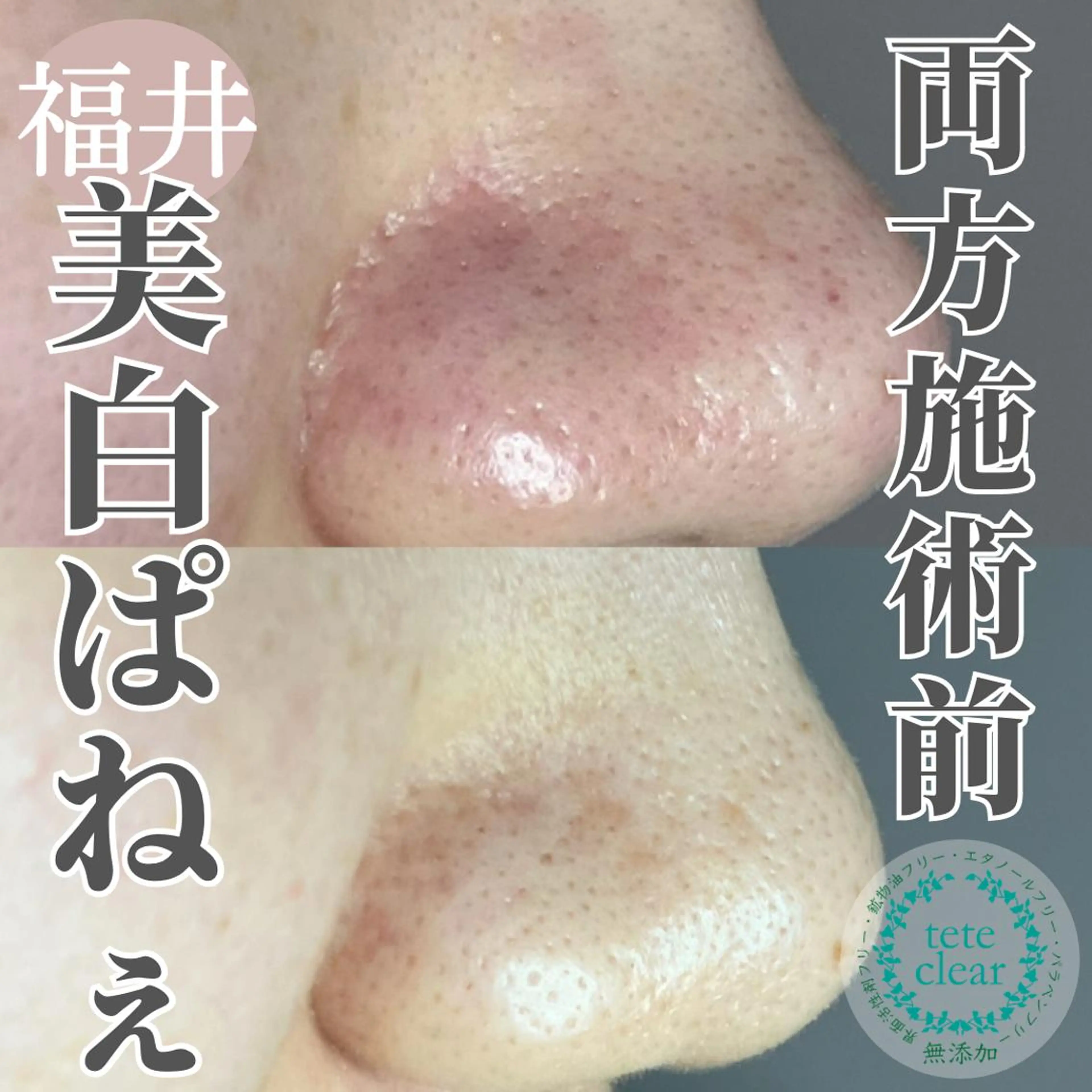 毛穴肌質ケアサロン Yourmeユアミーのエステ・リラクイメージ