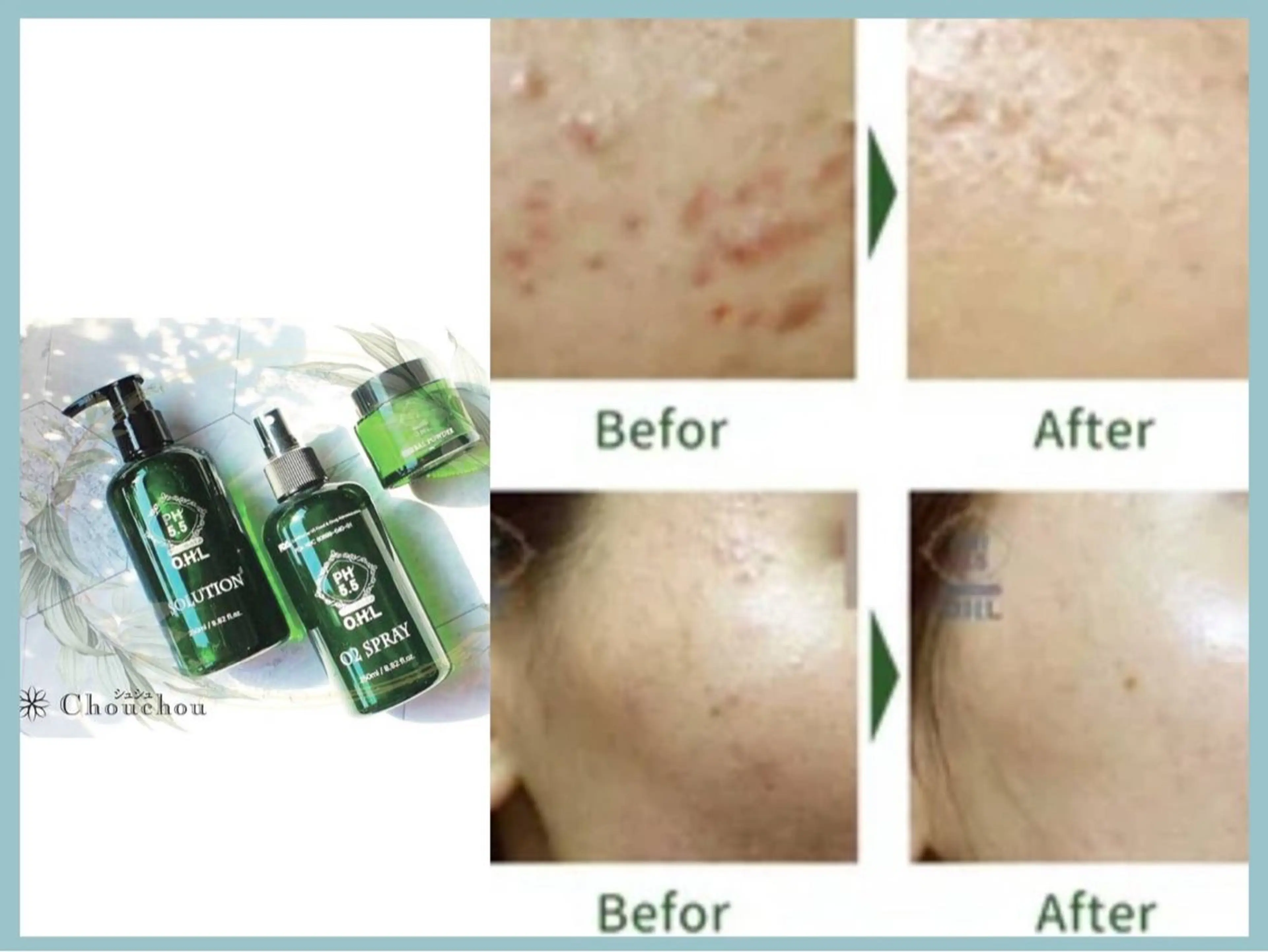 痩身・小顔・美肌専門 Chou chouのエステ・リラクイメージ