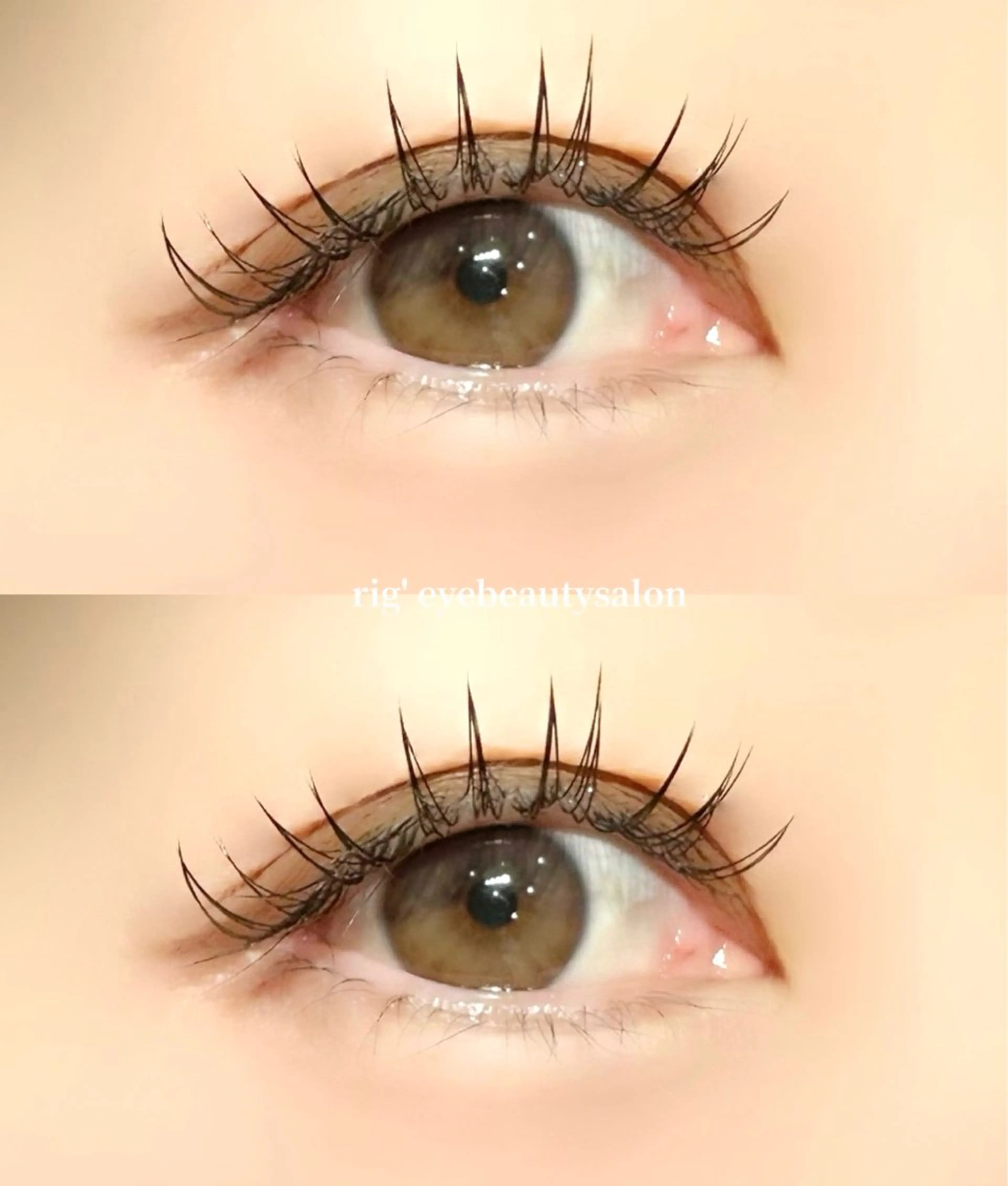 フラットラッシュ100本の写真