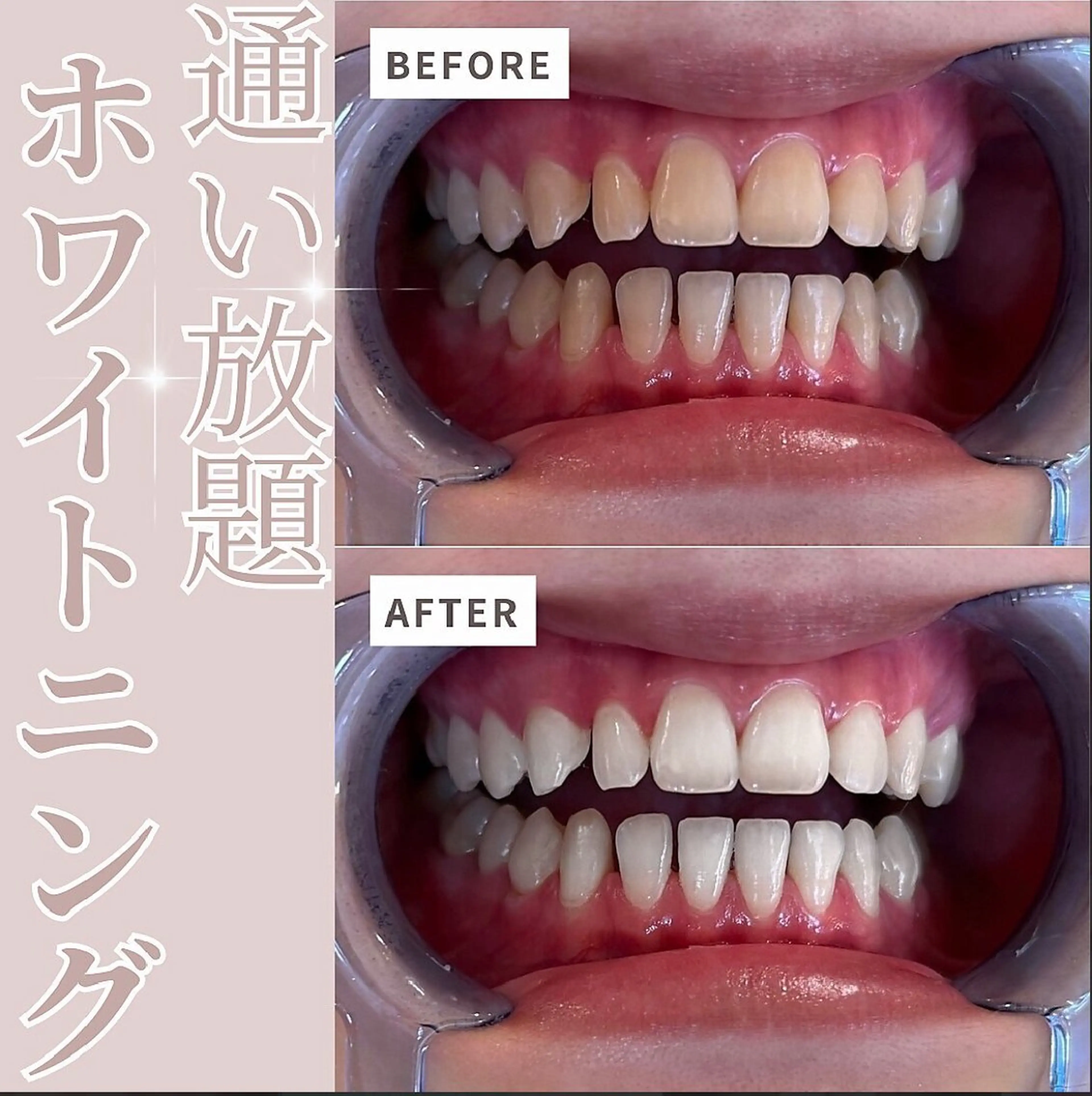 ecxia  white 　広島袋町店所属・セルフホワイトニング エクシア広島袋町店のその他イメージ