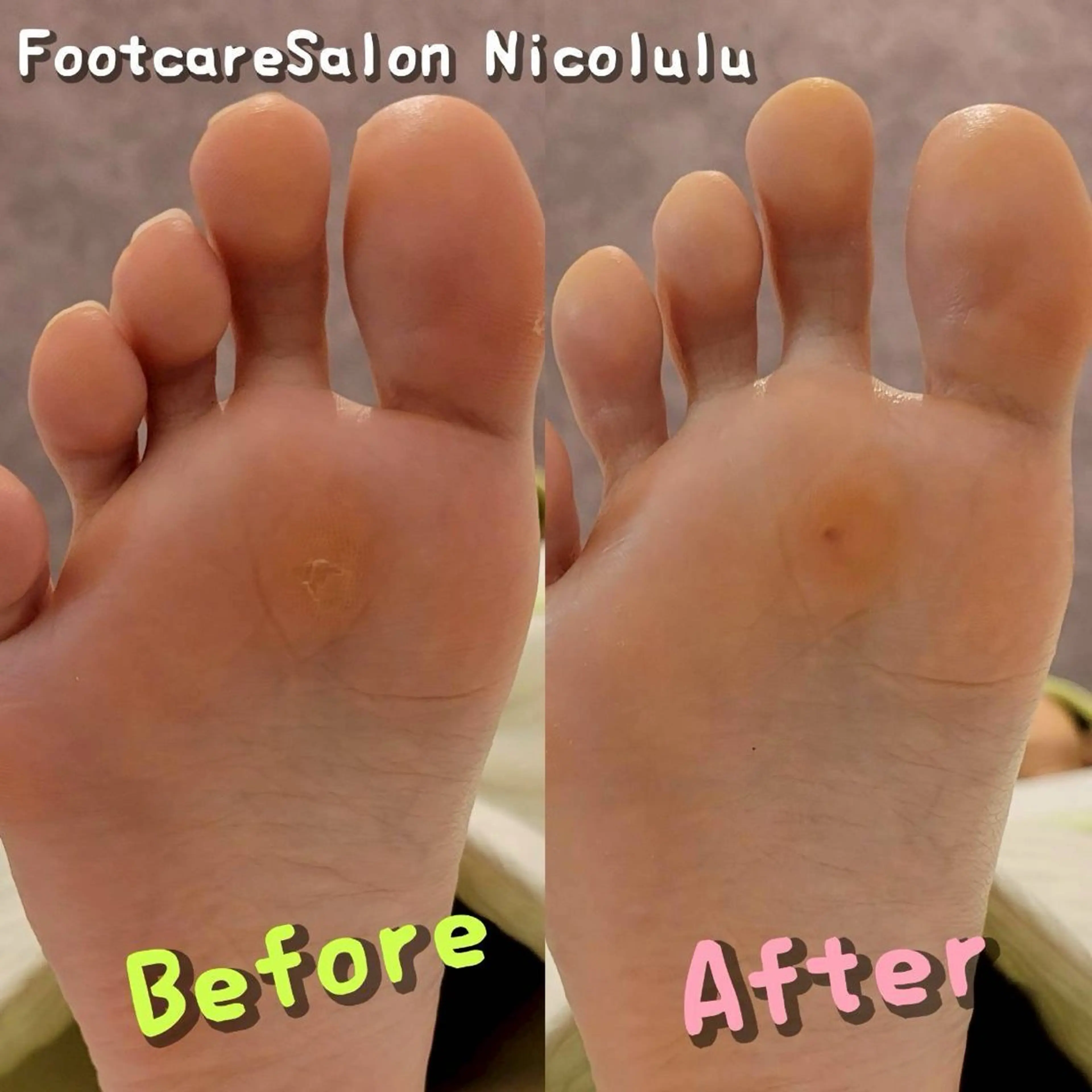 リラク 足トラブル専門 ニコルル金沢のエステ・リラクイメージ