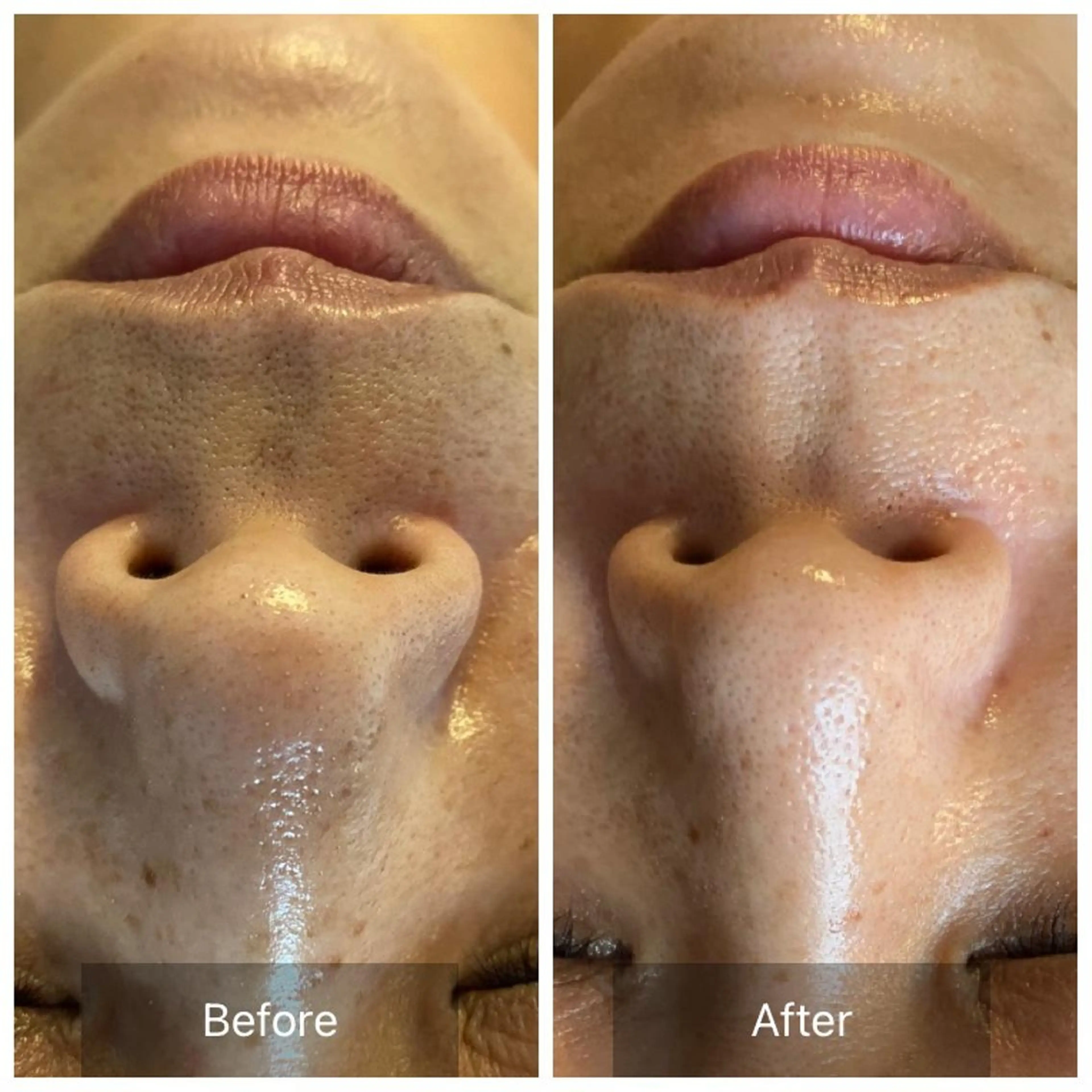 毛穴から始める肌メン テマンダリンオレンジのエステ・リラクイメージ