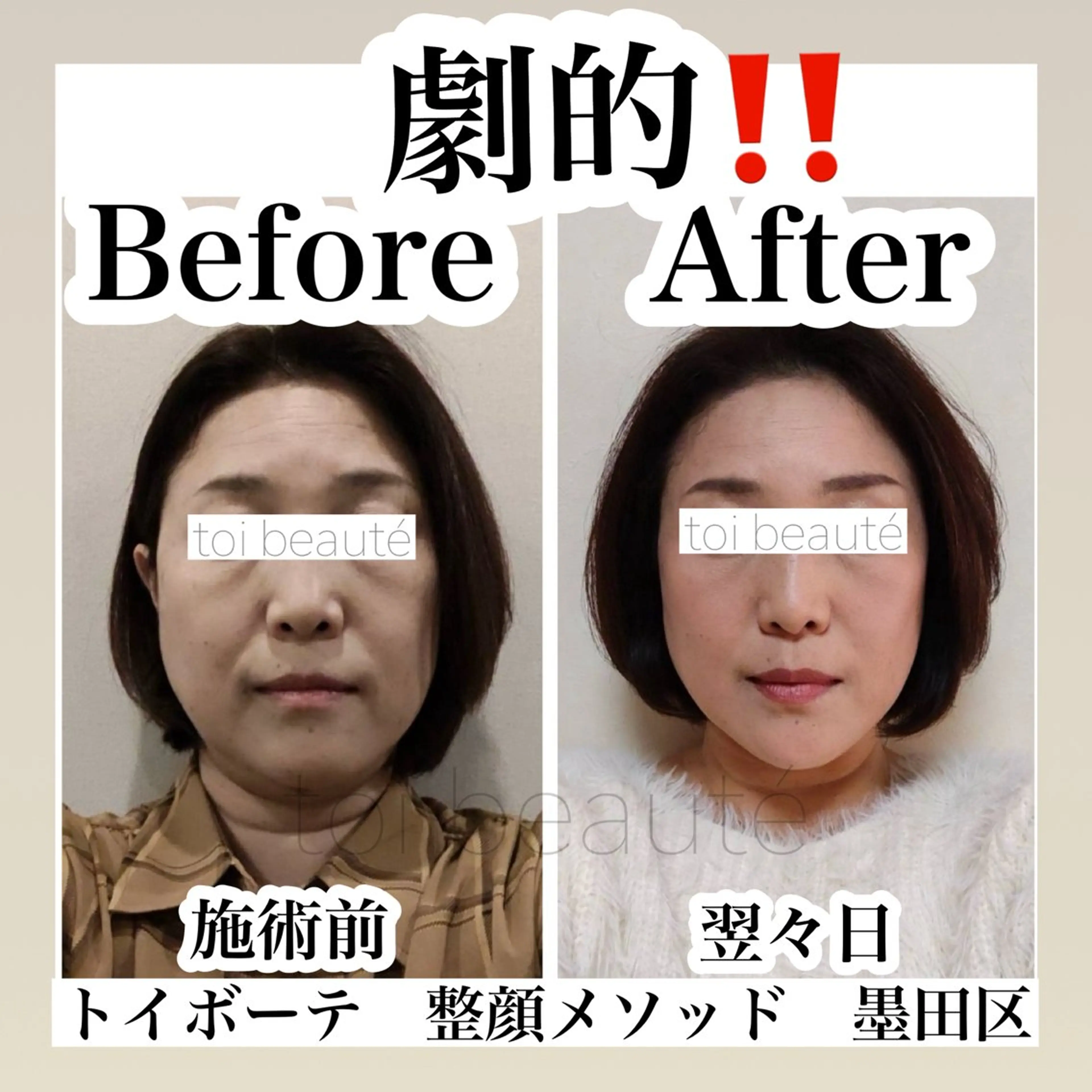 エステ 柳瀬 絵美のマツエク・マツパデザイン