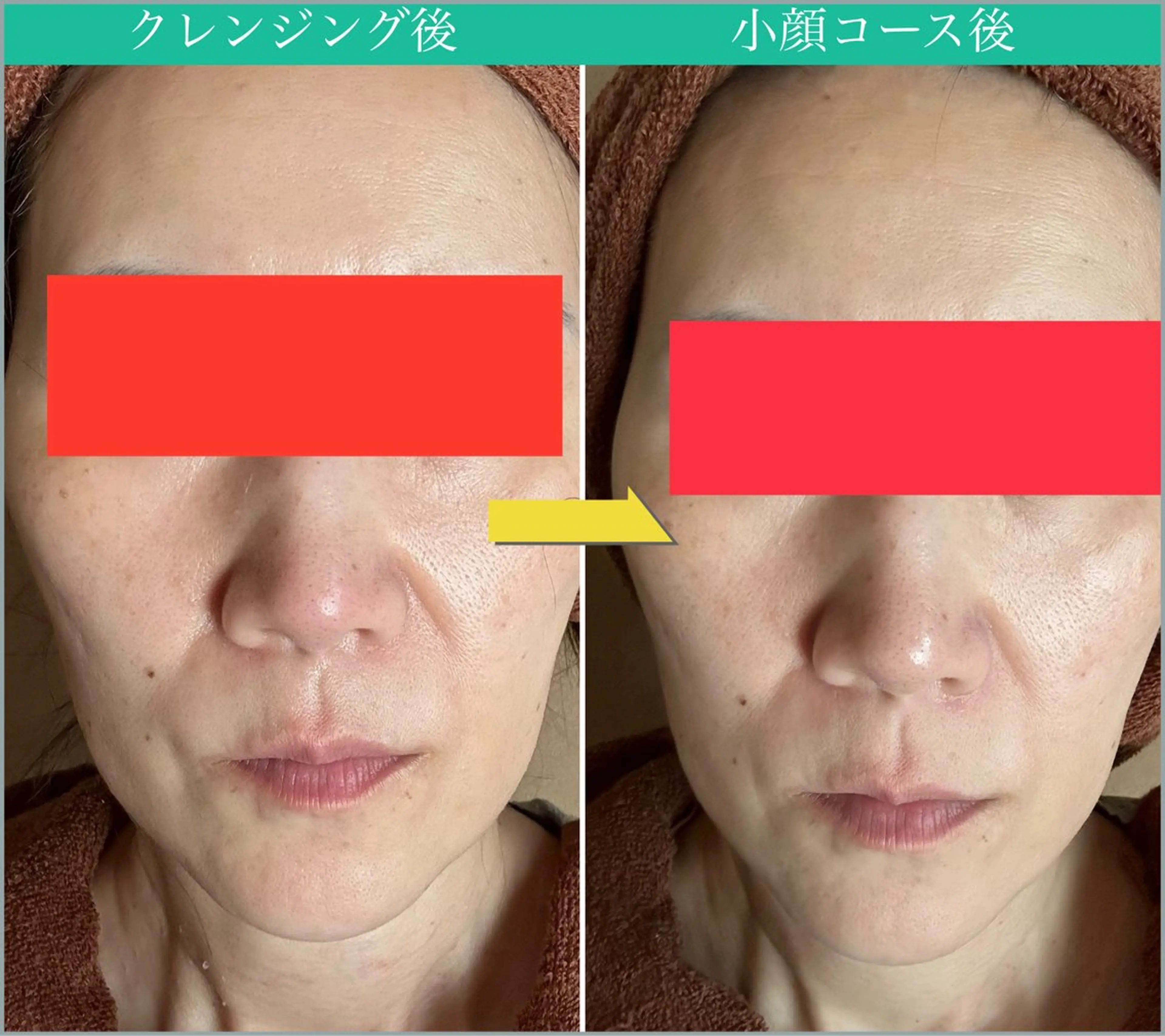 女性専用エステルーム Rerelaリレラのエステ・リラクイメージ