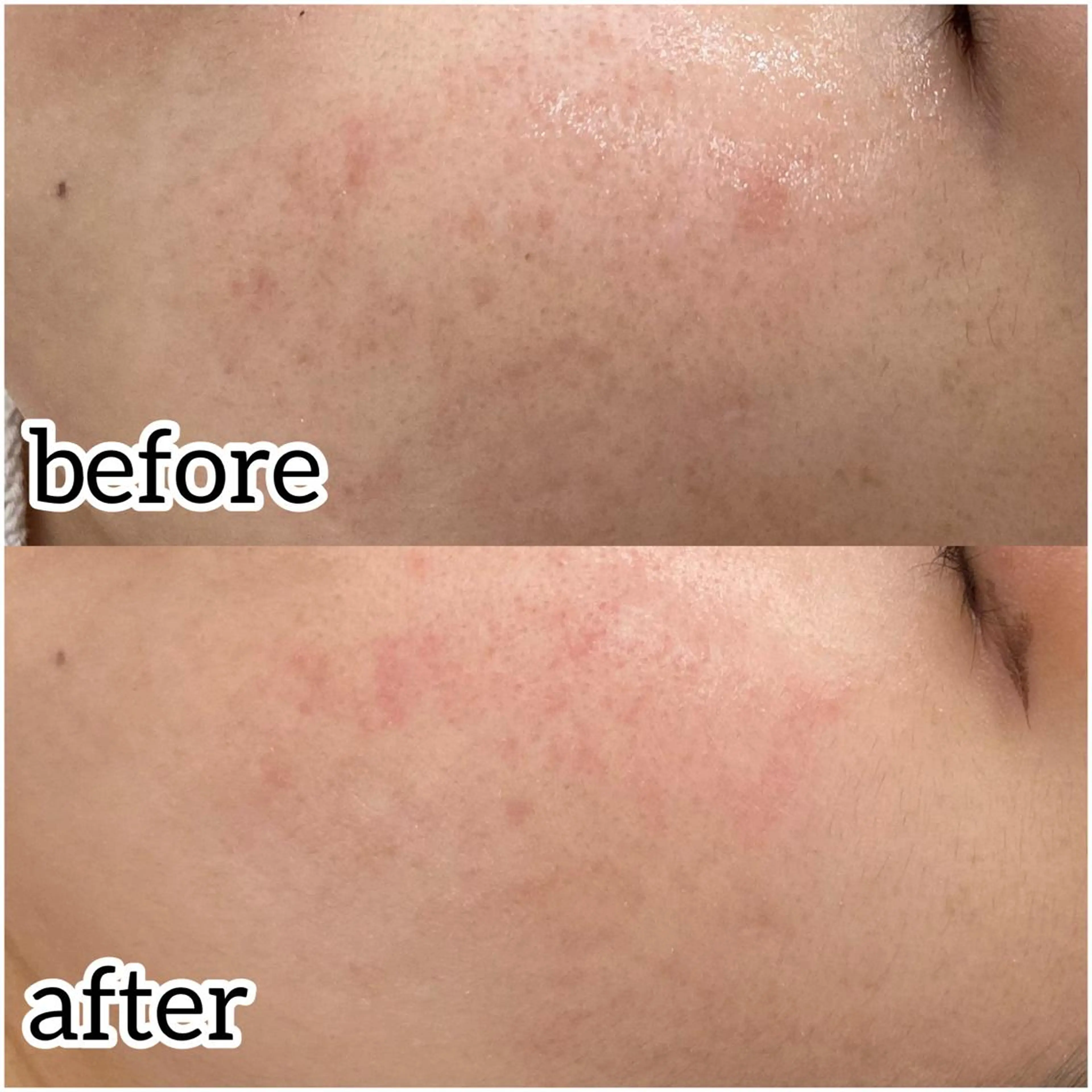 laluna saki...のその他イメージ