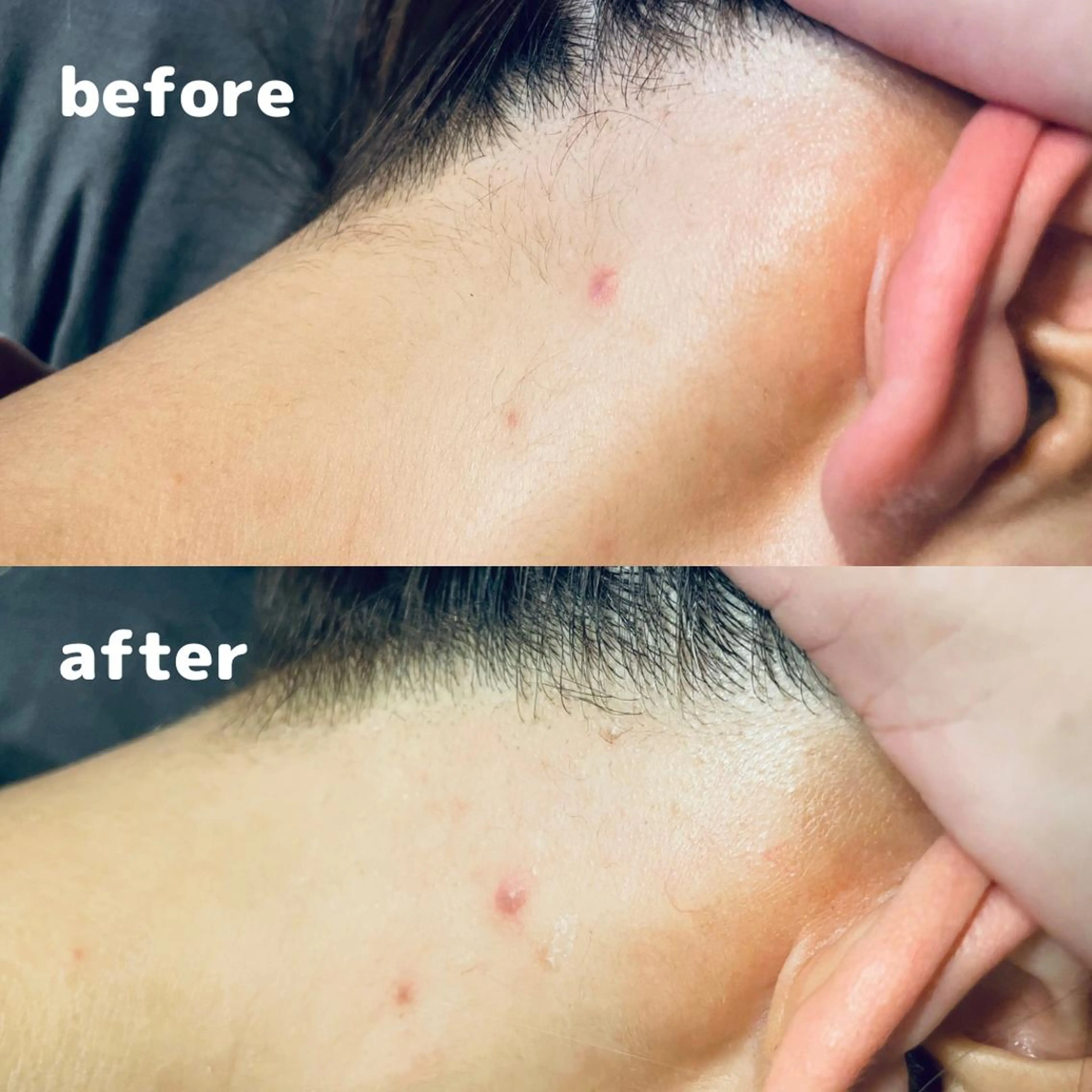 脱毛 Pono所属・Pono （ポノ）のエステ・リラクイメージ