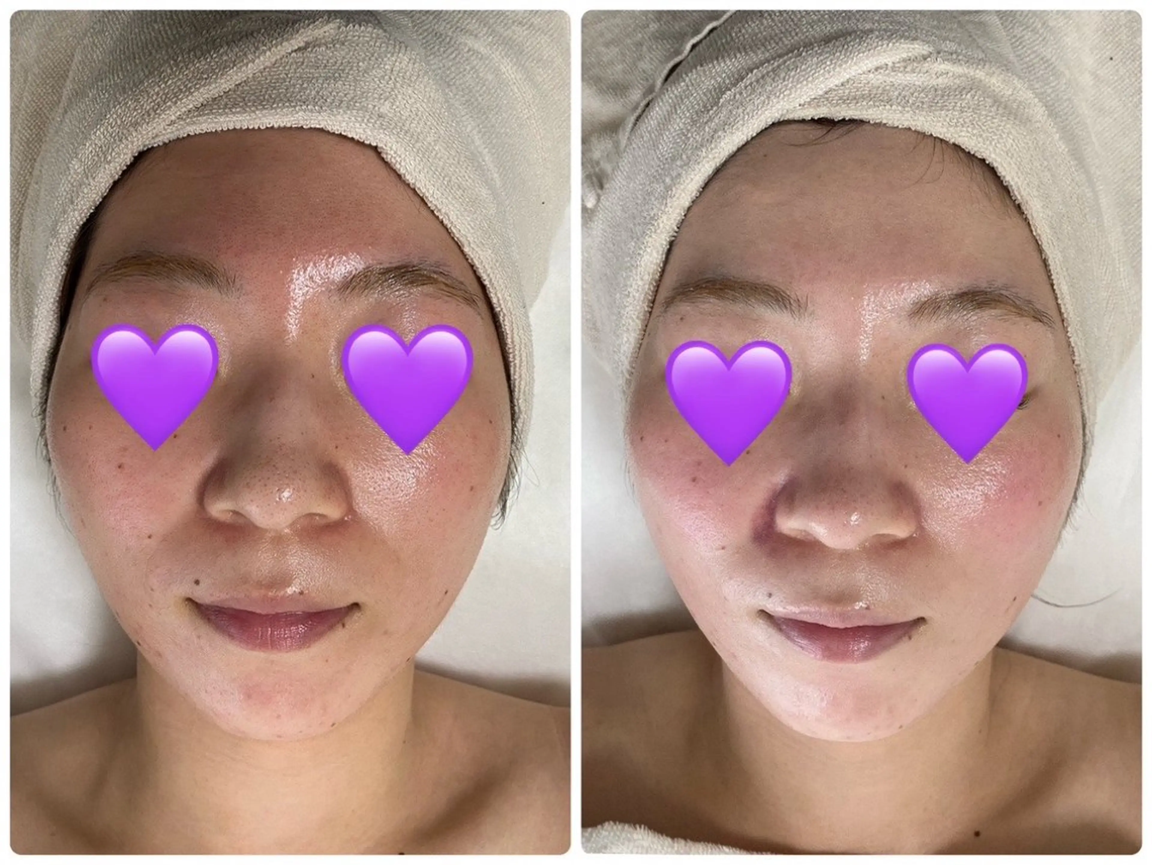 エステ COCO beautyサロンのエステ・リラクイメージ